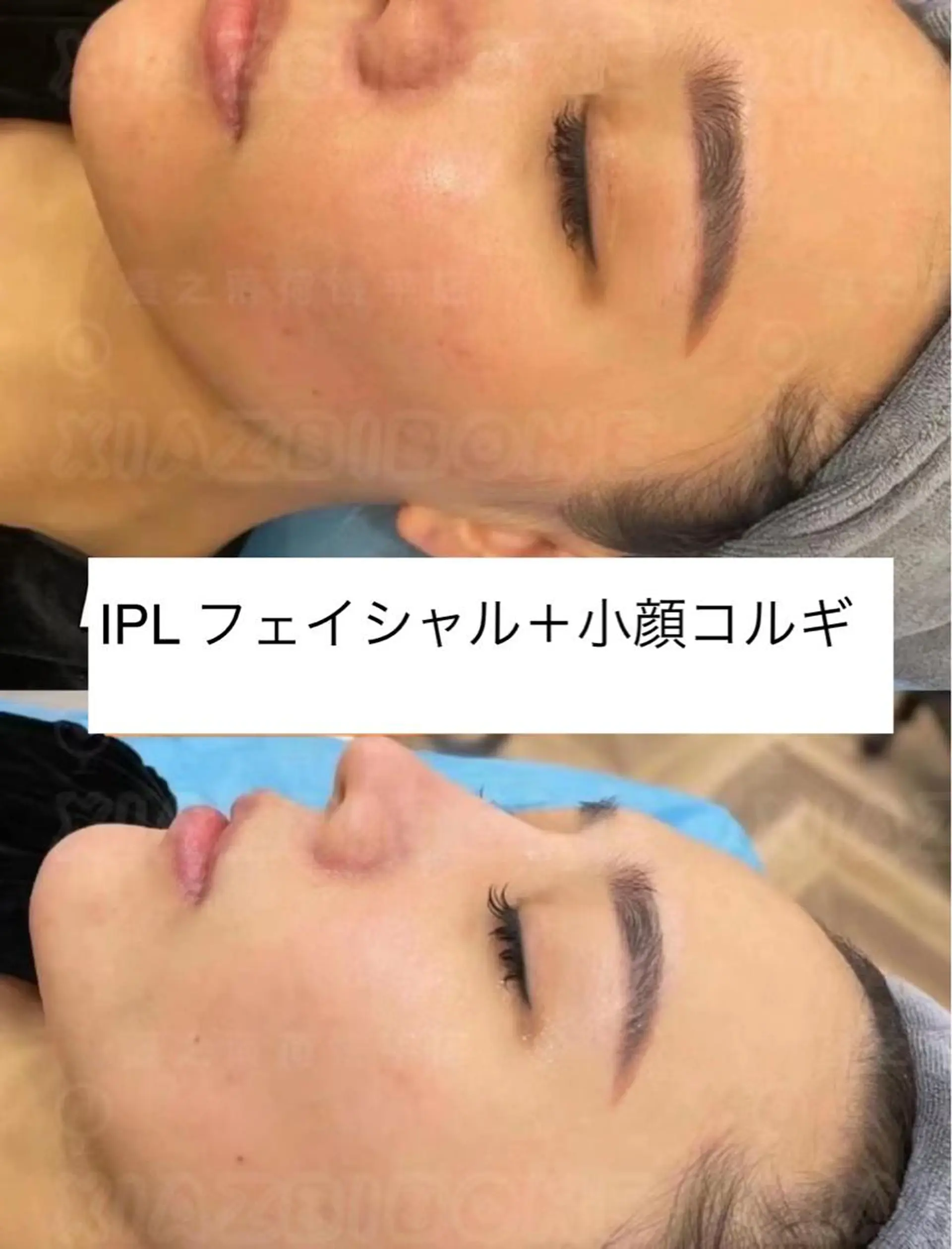 【ハイパーナイフ痩身&小顔コルギ&ハーブピーリング】K-Beauty　東新宿所属・kーbeauty痩身 フェイシャルのエステ・リラクイメージ