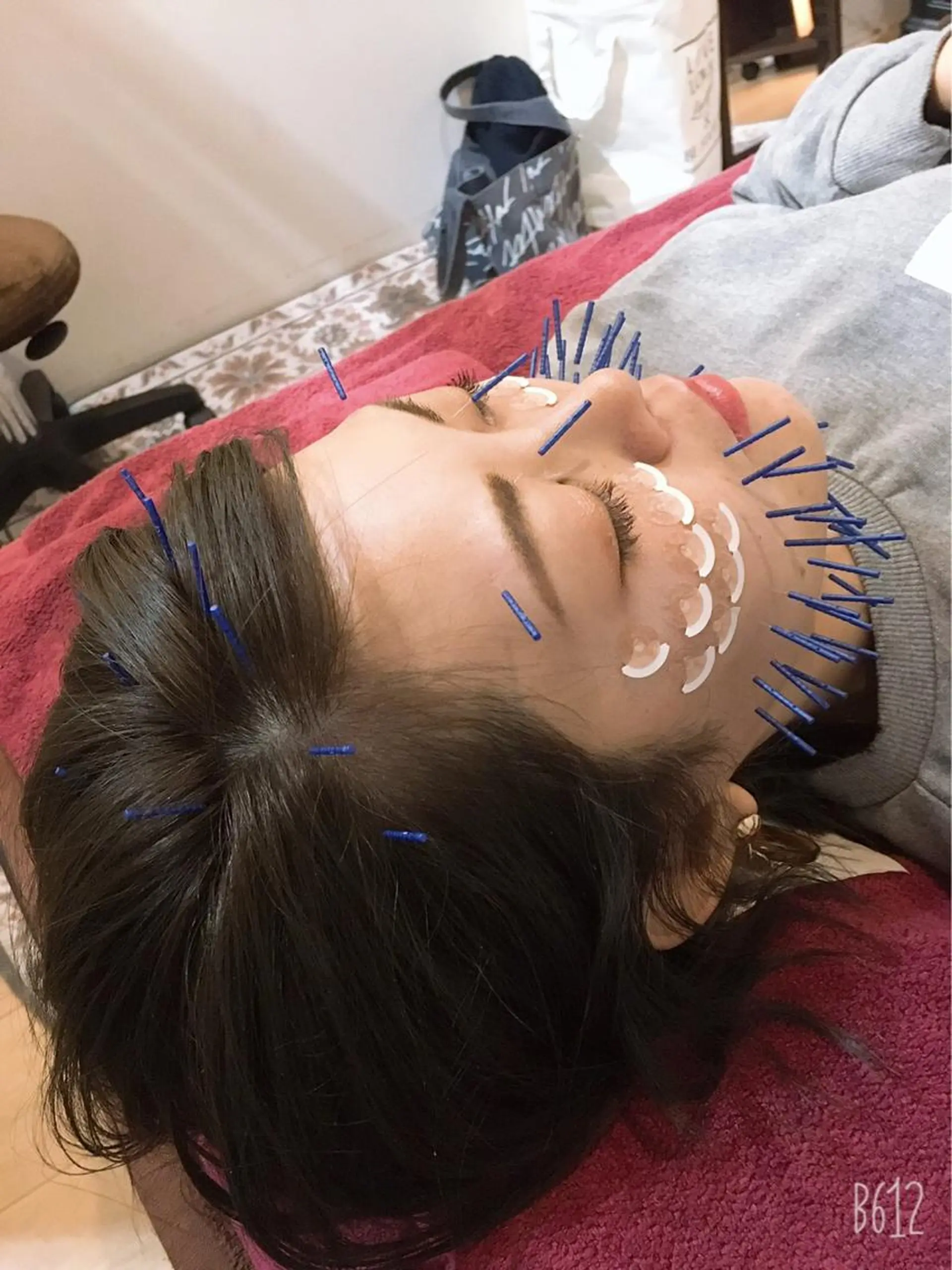 エステ リラク 美容鍼灸女性専用 りんご鍼灸治療院のその他イメージ