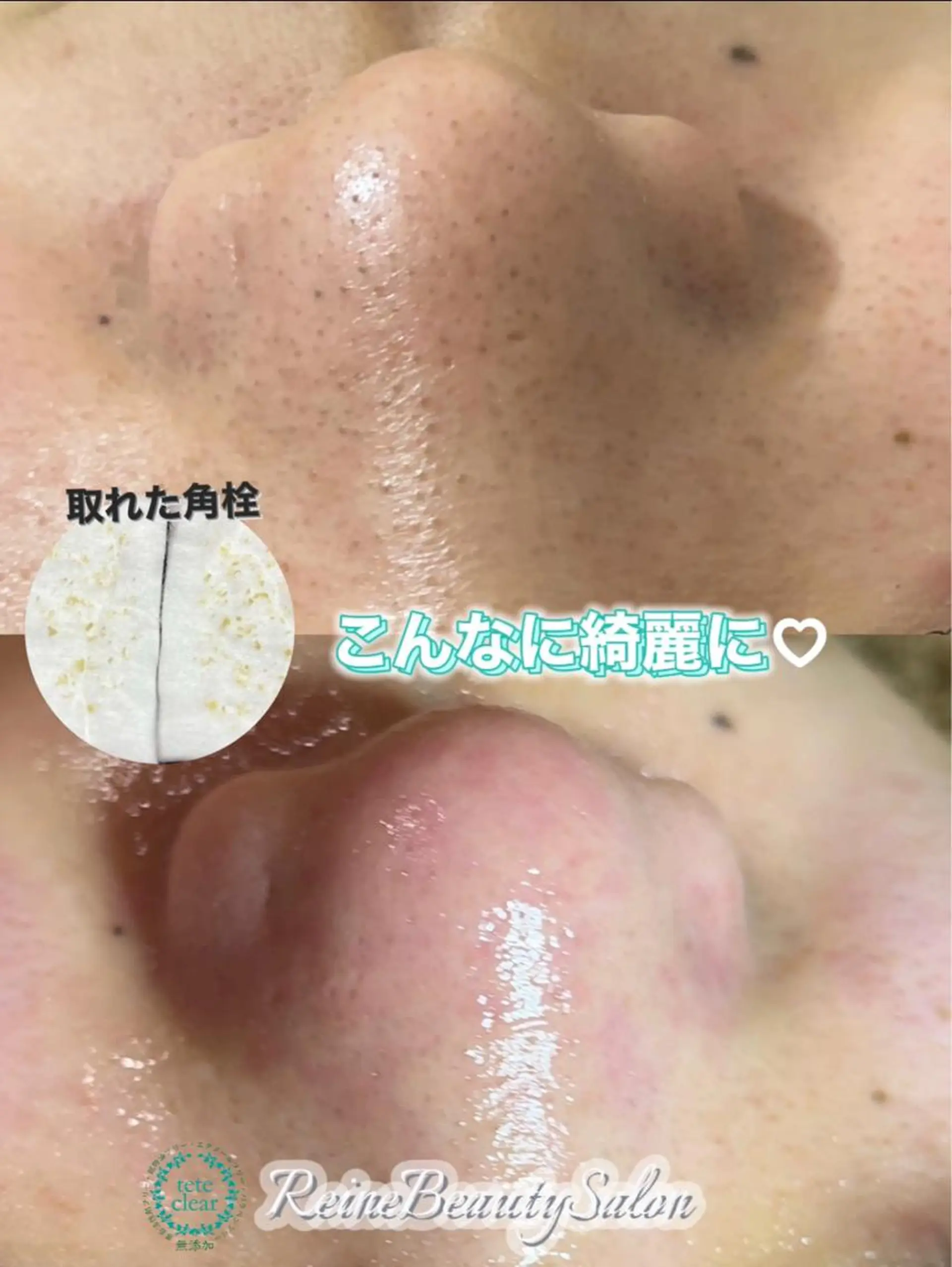 Reine BeautySalon所属・毛穴/シミ肝斑/脱毛 横山梨里のエステ・リラクイメージ
