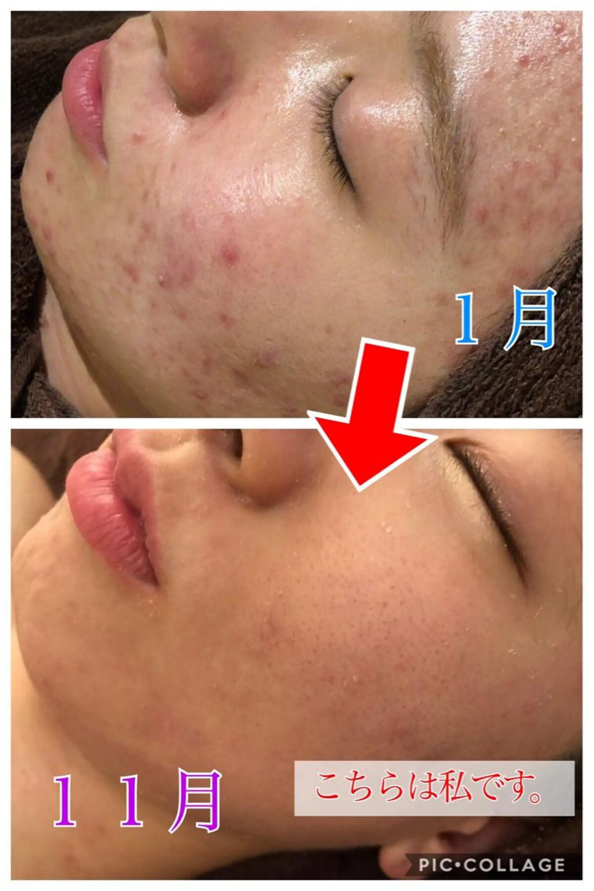セミロング カラー パーマ ヘアアレンジ メンズ キッズ マツエク・マツパ 四つ星サロン🎖 腸＆ニキビケアに特化のエステ・リラクイメージ