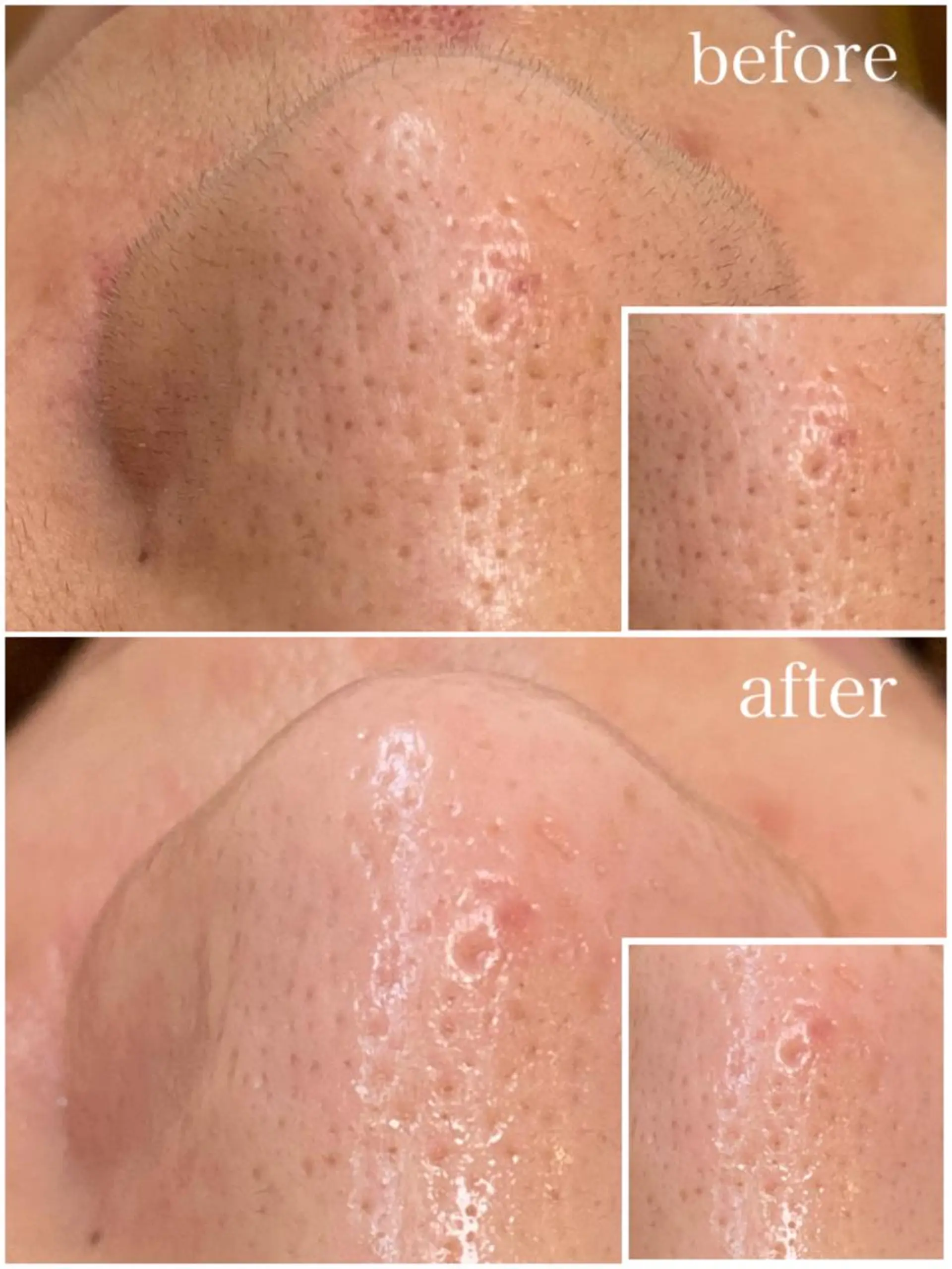 韓国肌管理 【毛穴専科】のエステ・リラクイメージ