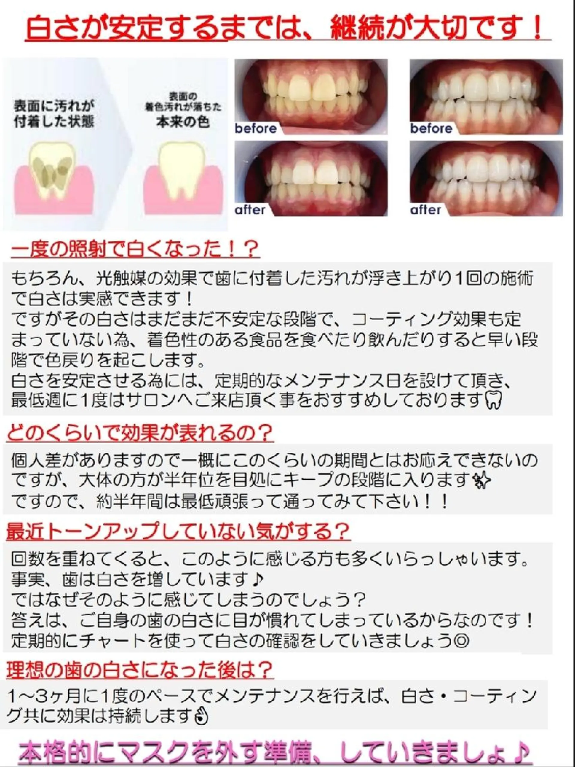 その他 セルフホワイトニング エクシア大宮東口店所属・セルフホワイトニング エクシア大宮東口店のその他イメージ