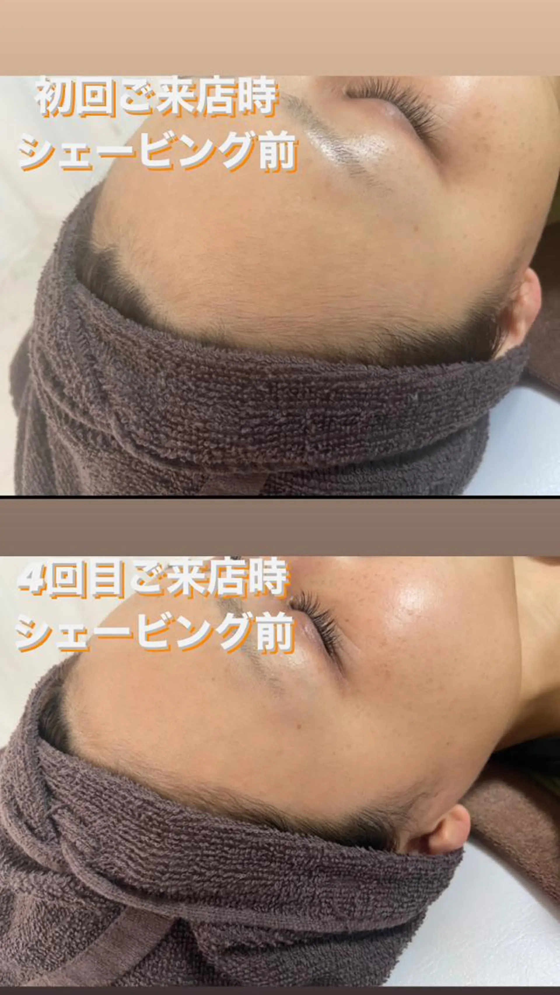 脱毛 都度払い制脱毛サロンBe Charm所属・Be Charm 山﨑のエステ・リラクイメージ