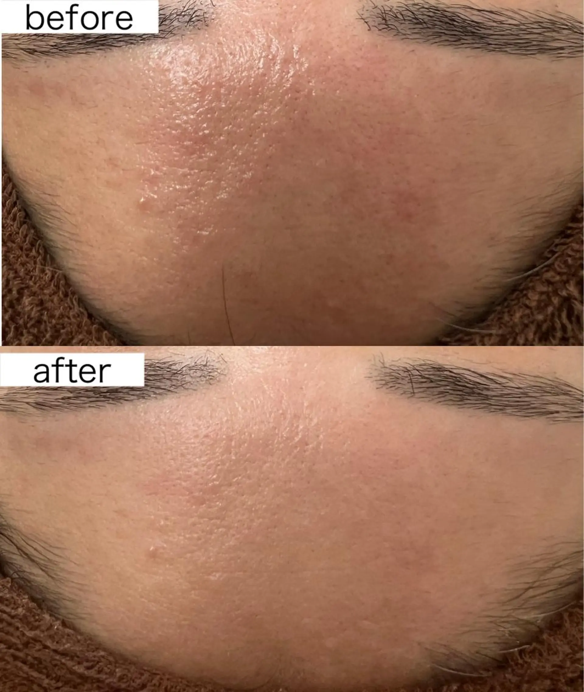 Beauty   Salon  Adiy所属・Adiy ikumiのエステ・リラクイメージ