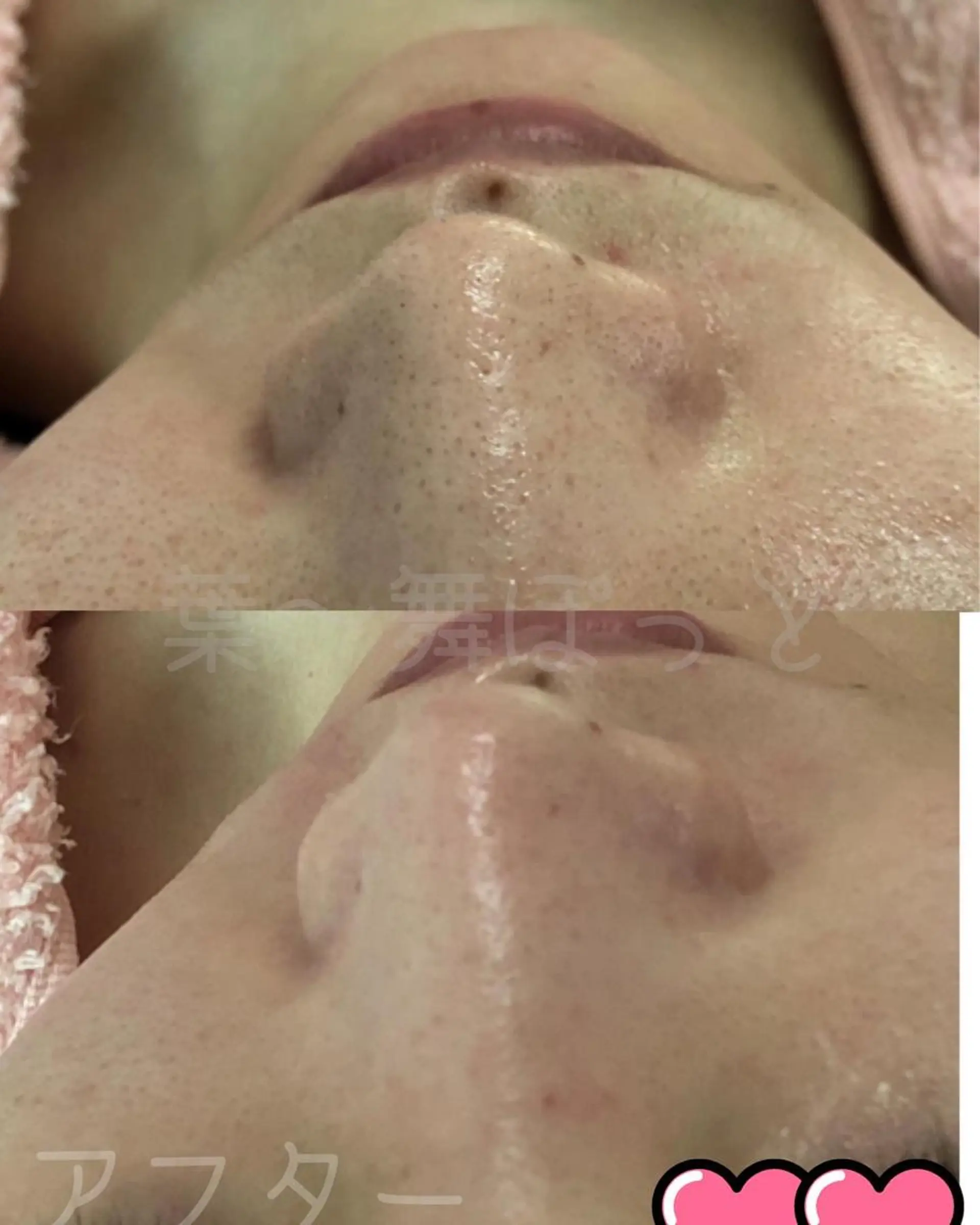 うえつま ふみえのエステ・リラクイメージ