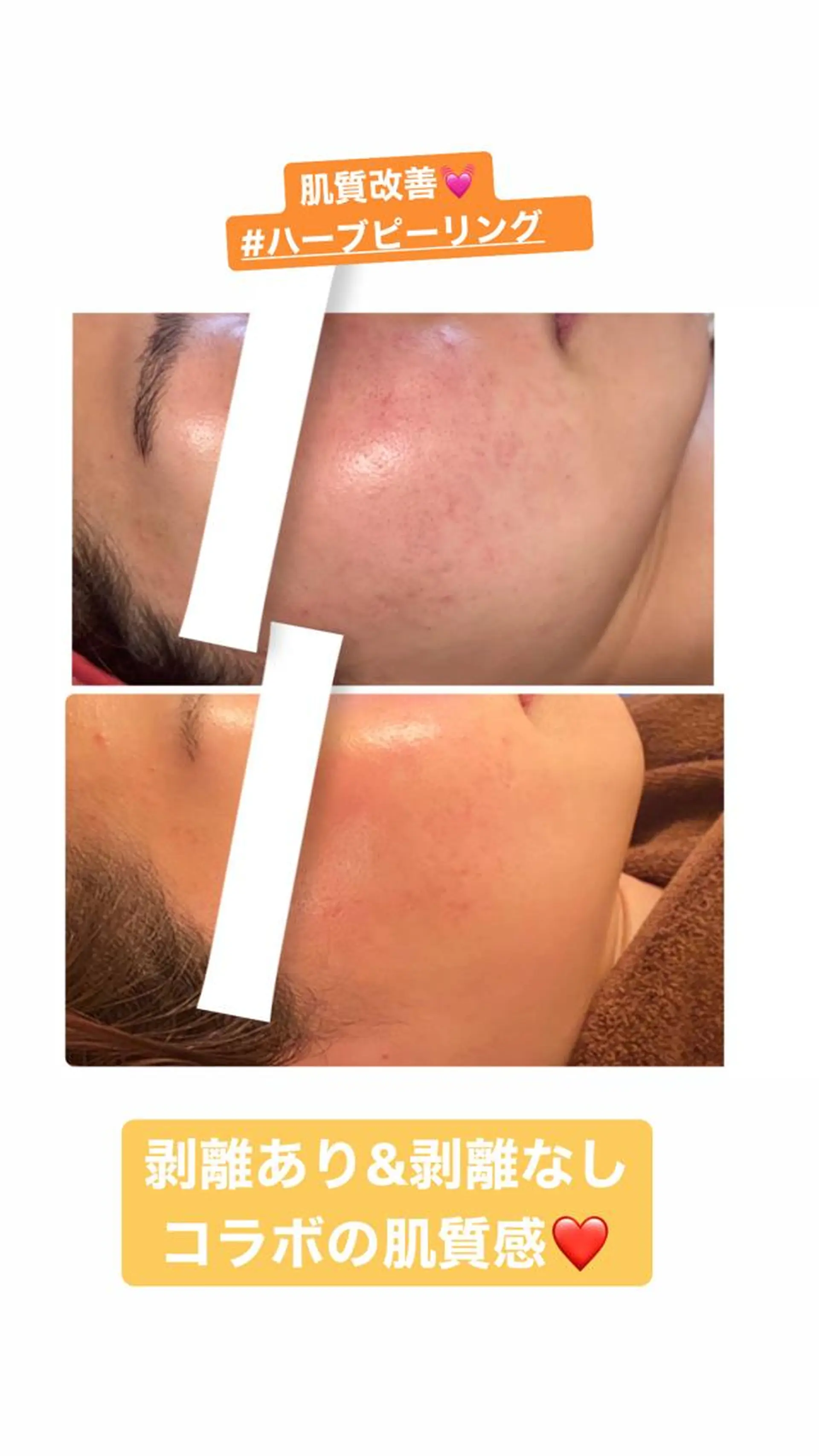 FLEUR大阪・整体 ・ハイフ・痩身・小顔のエステ・リラクイメージ