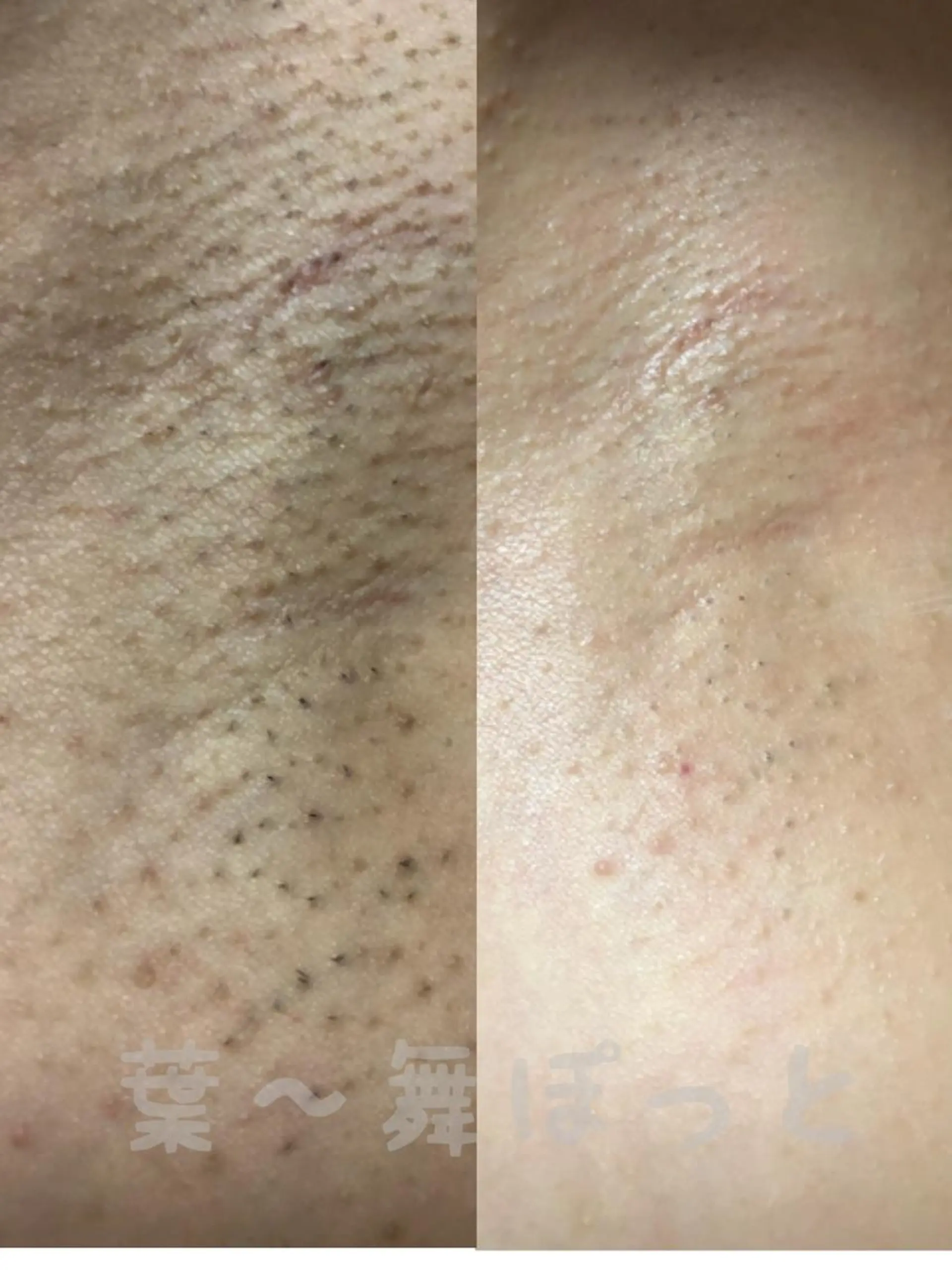 うえつま ふみえのエステ・リラクイメージ