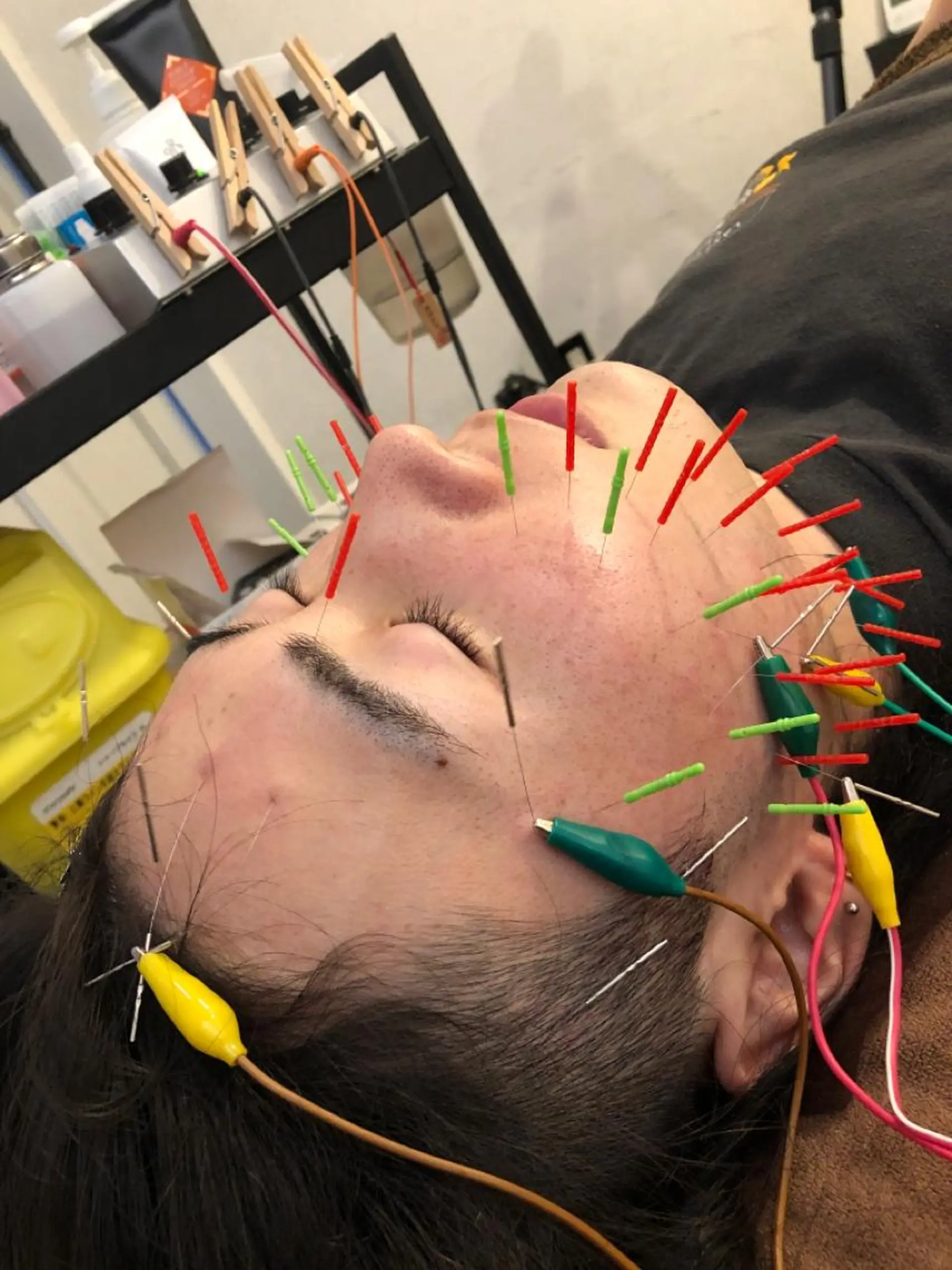 その他 美容鍼灸整体サロンBeauJu所属・小顔矯/美容鍼/鍼灸 BeauJuのその他イメージ