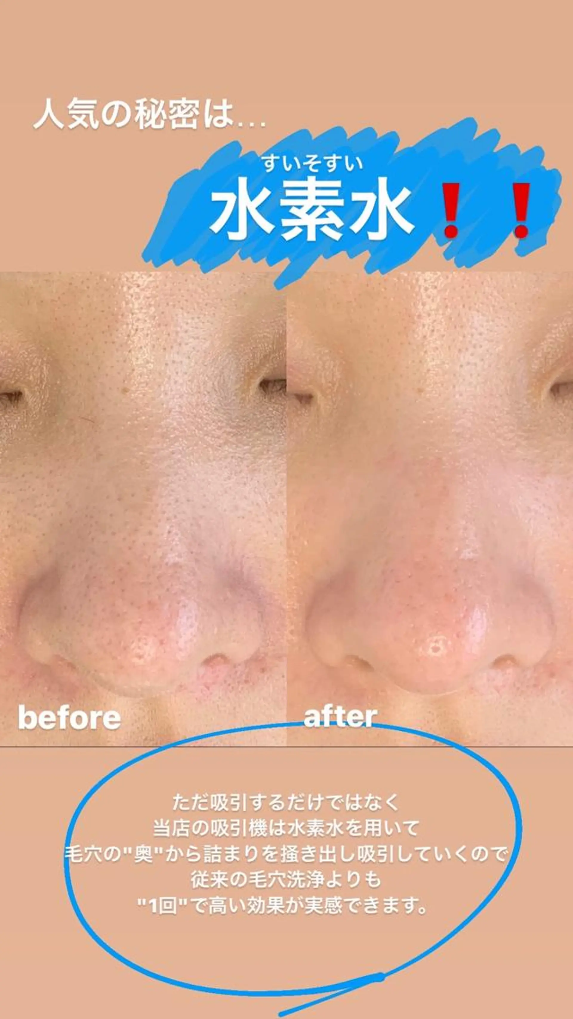 メンズ エステ salonLADYSTYLE所属・稲嶺 美華のエステ・リラクイメージ