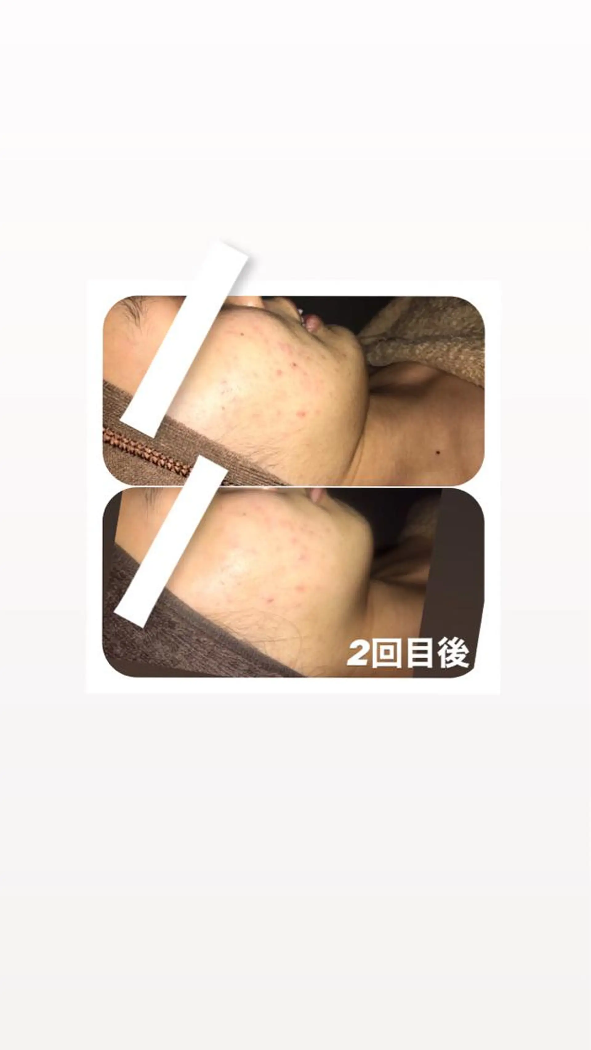 エステ 鬼👹リンパ妊活 生理痛改善足圧サロンのエステ・リラクイメージ