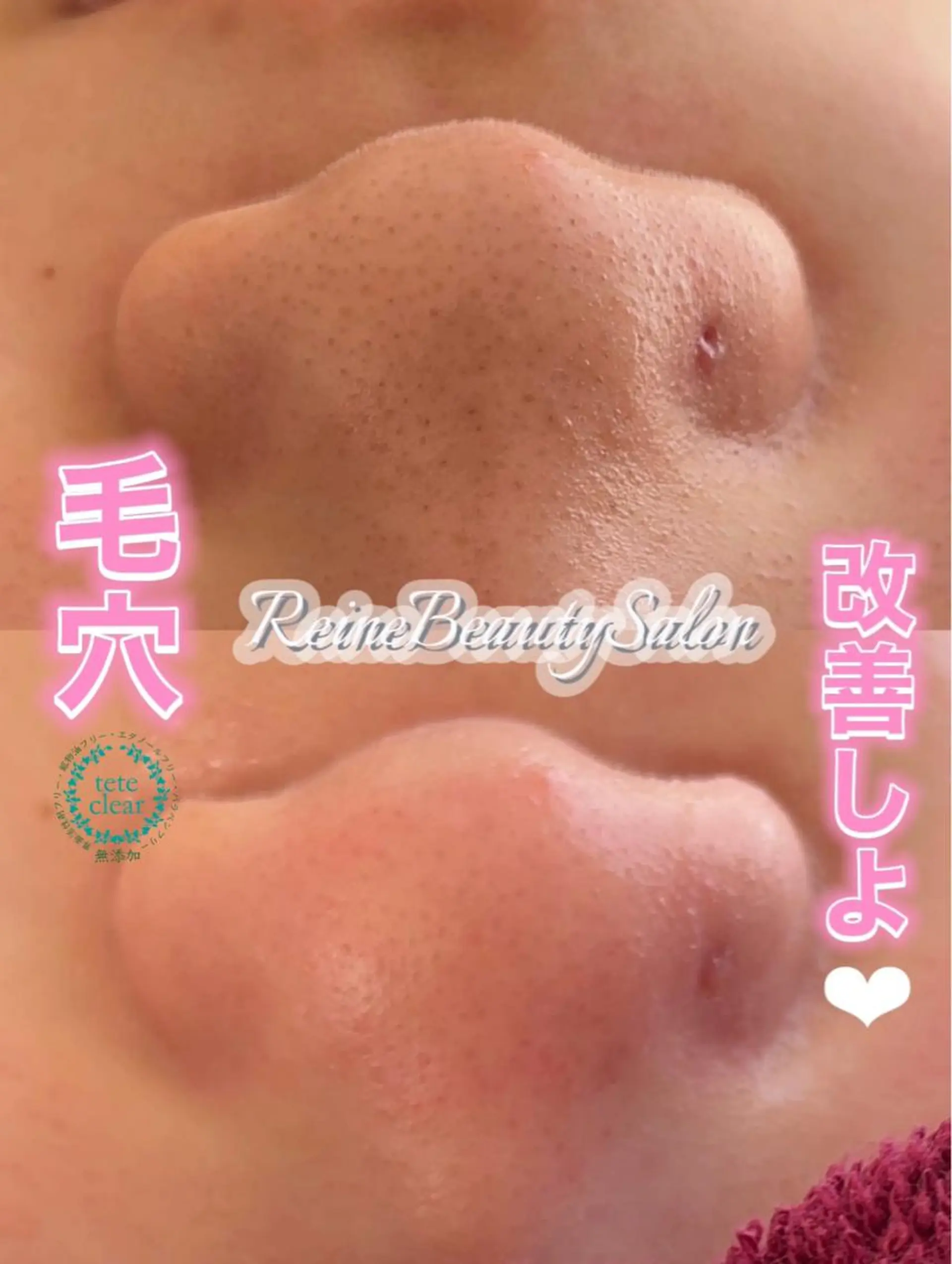 エステ Reine BeautySalon所属・毛穴/シミ肝斑/脱毛 横山梨里のエステ・リラクイメージ