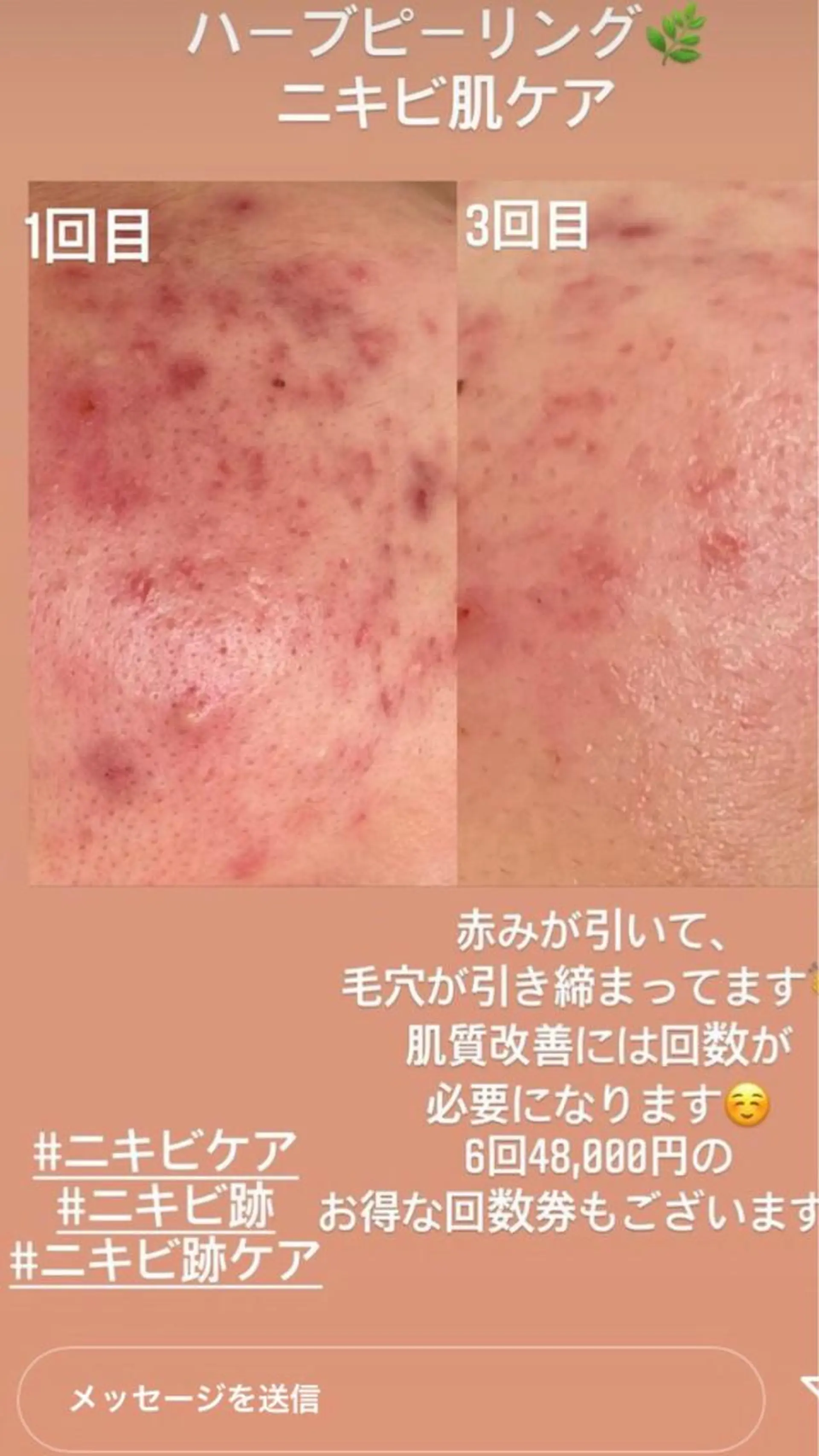 ベルーテ エッセンスのエステ・リラクイメージ