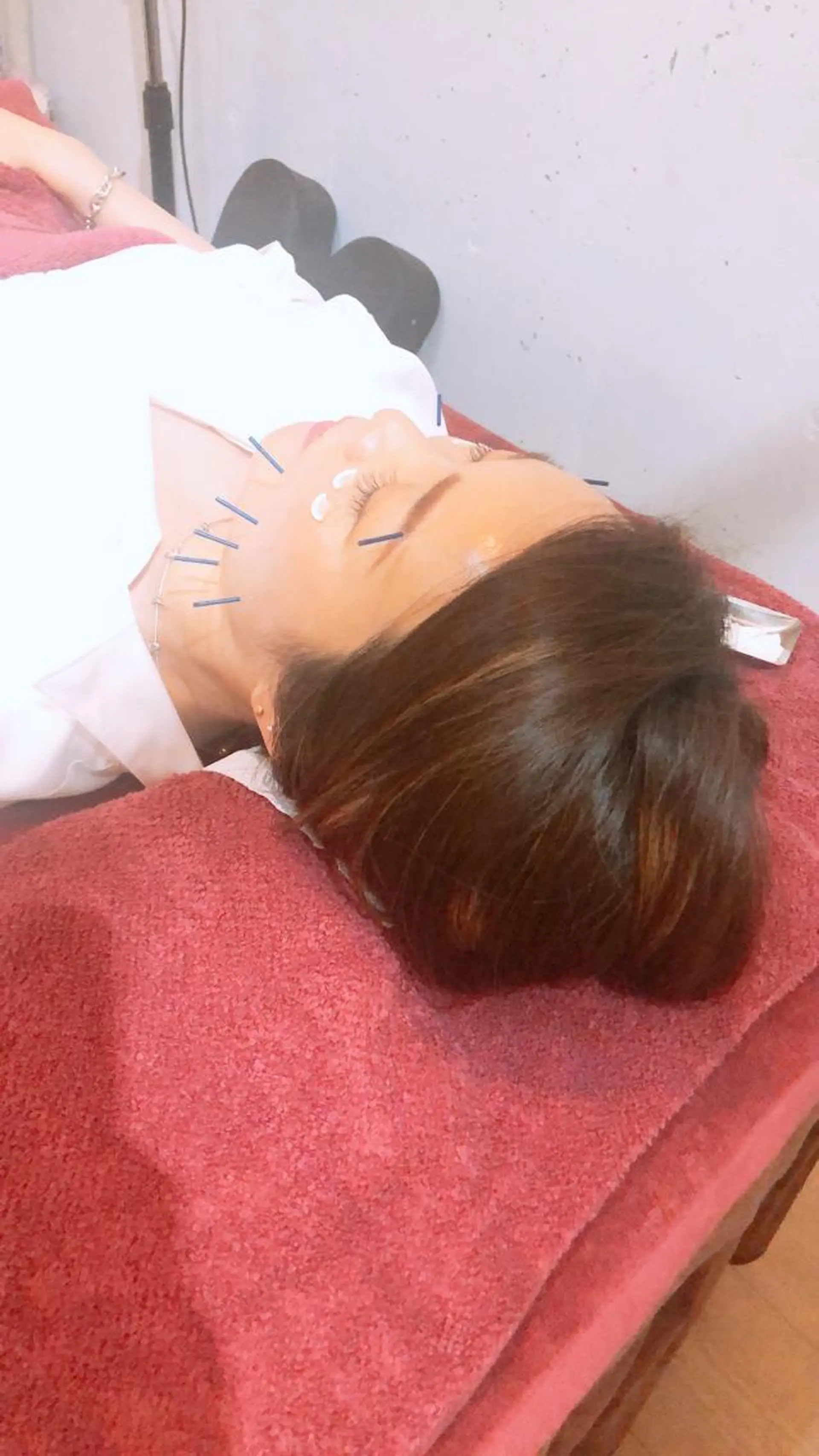 美容鍼灸女性専用 りんご鍼灸治療院のその他イメージ