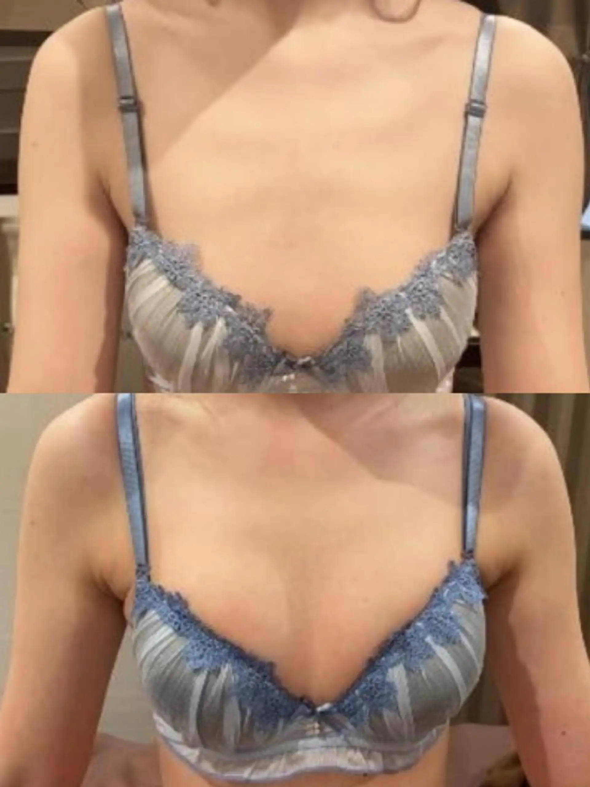 エステ 美乳バストサロン RAYVIS💍のエステ・リラクイメージ