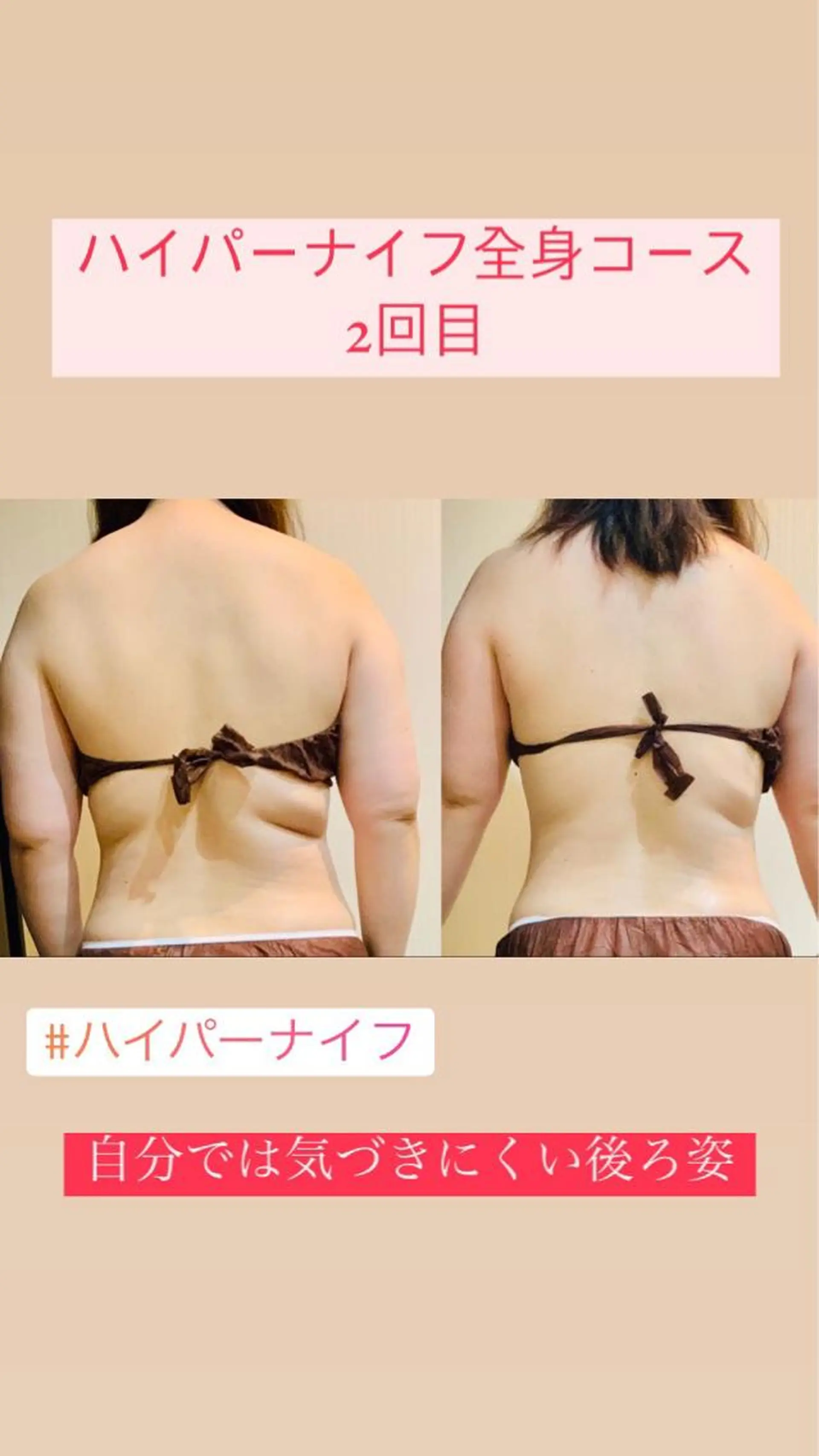 Einami 美肌痩身サロンのエステ・リラクイメージ