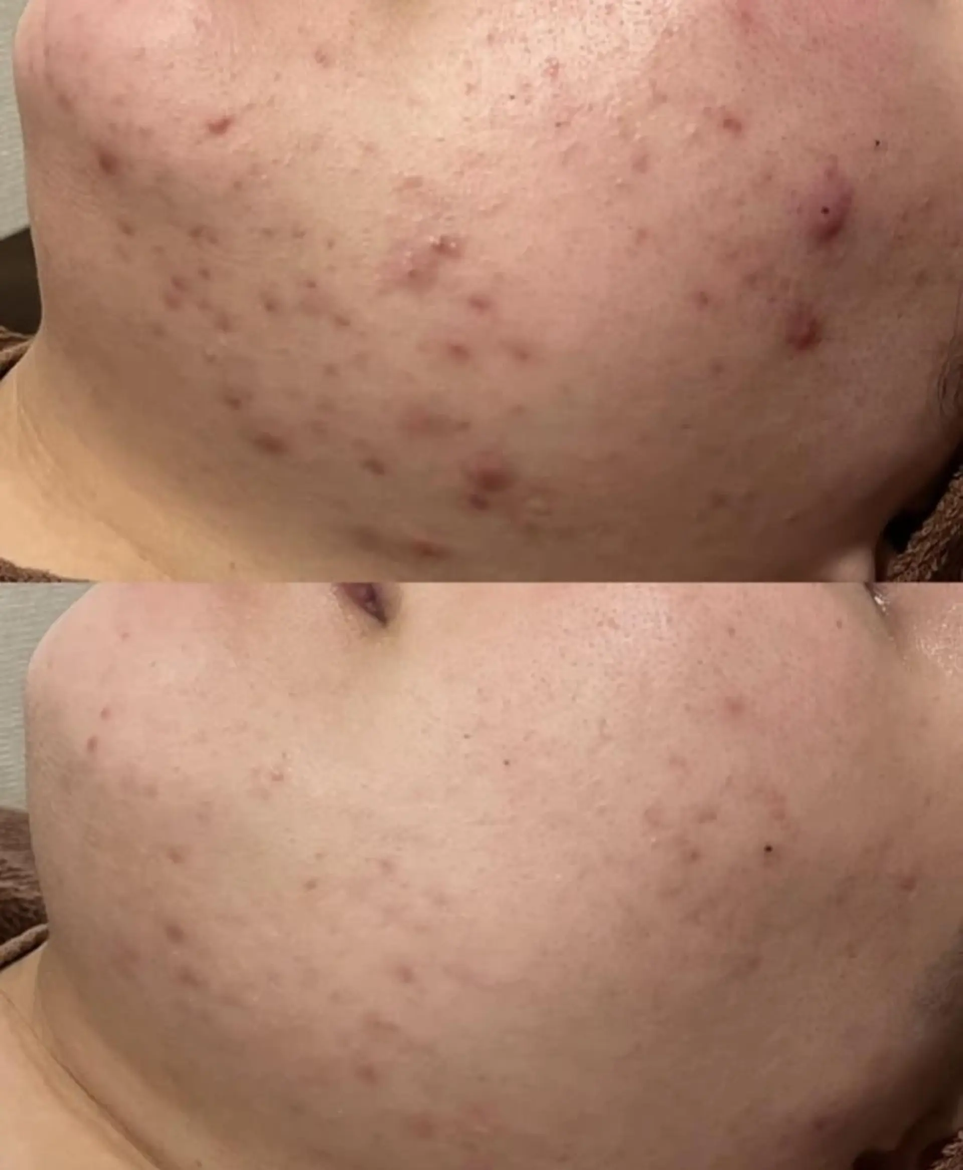 ニキビ・肌質改善専門 ♡人生が変わるサロンのエステ・リラクイメージ