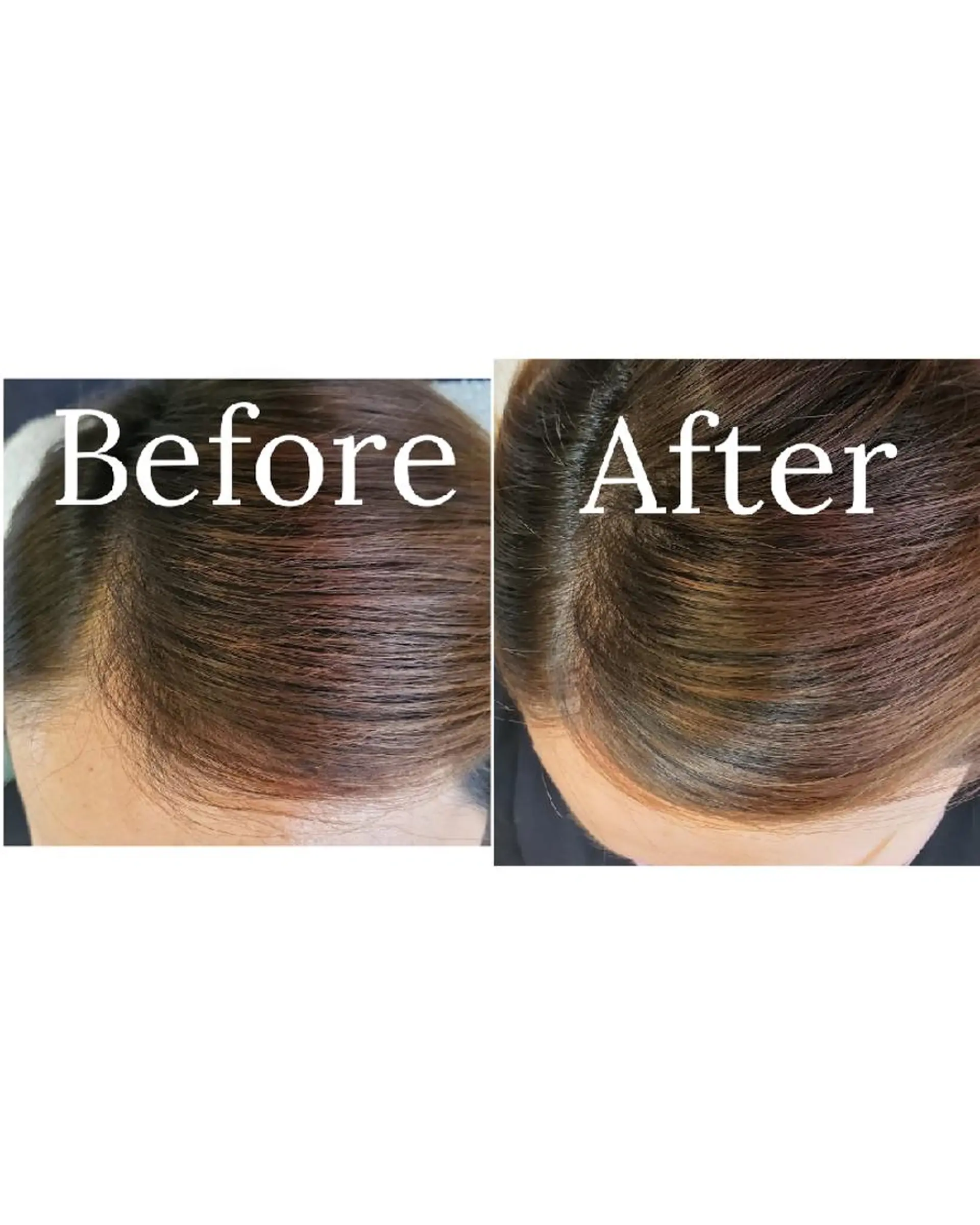 エクステ 歯科提携セルフダック 宇都宮駒生店のエステ・リラクイメージ