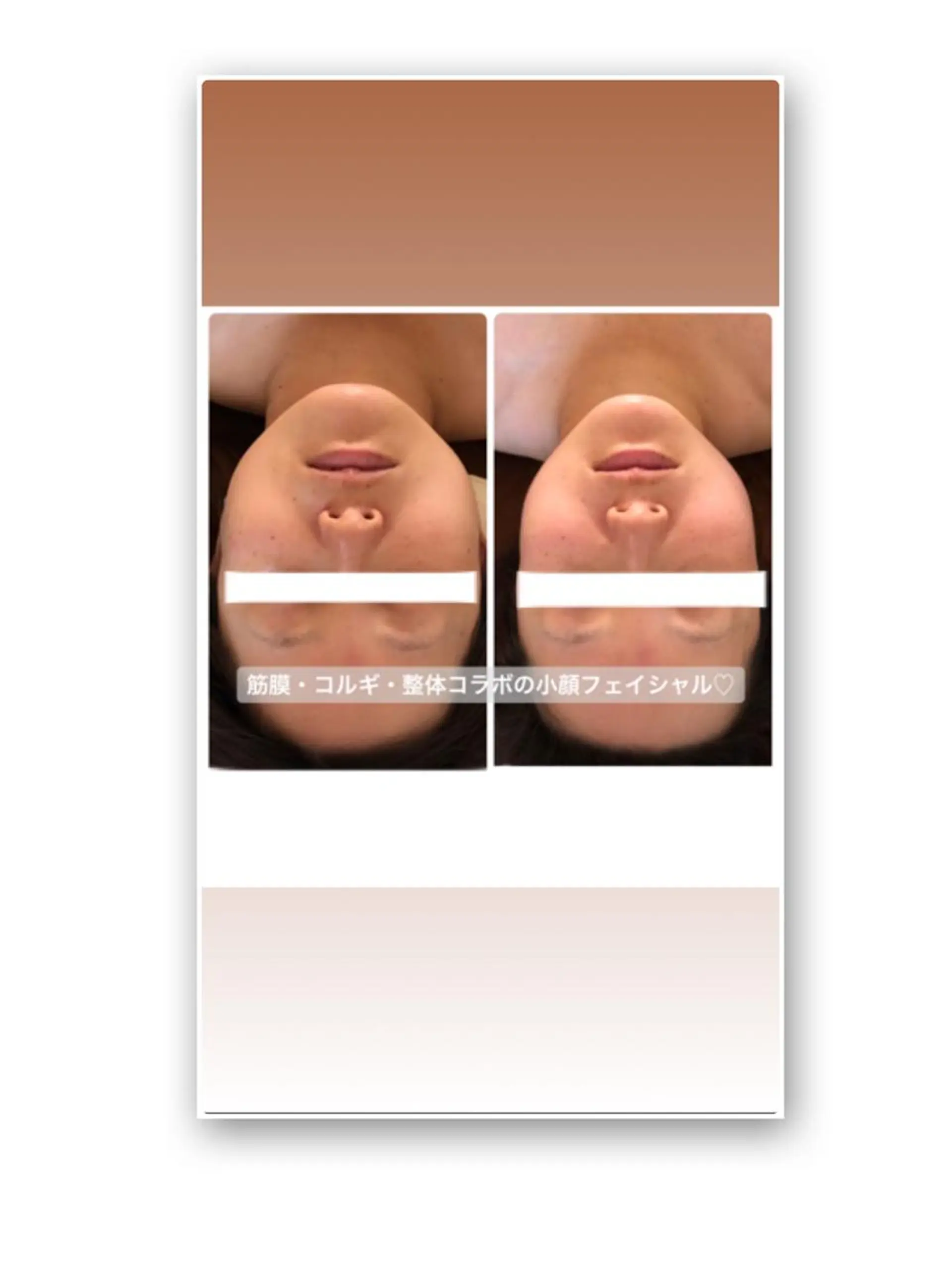 FLEUR大阪・整体 ・ハイフ・痩身・小顔のエステ・リラクイメージ