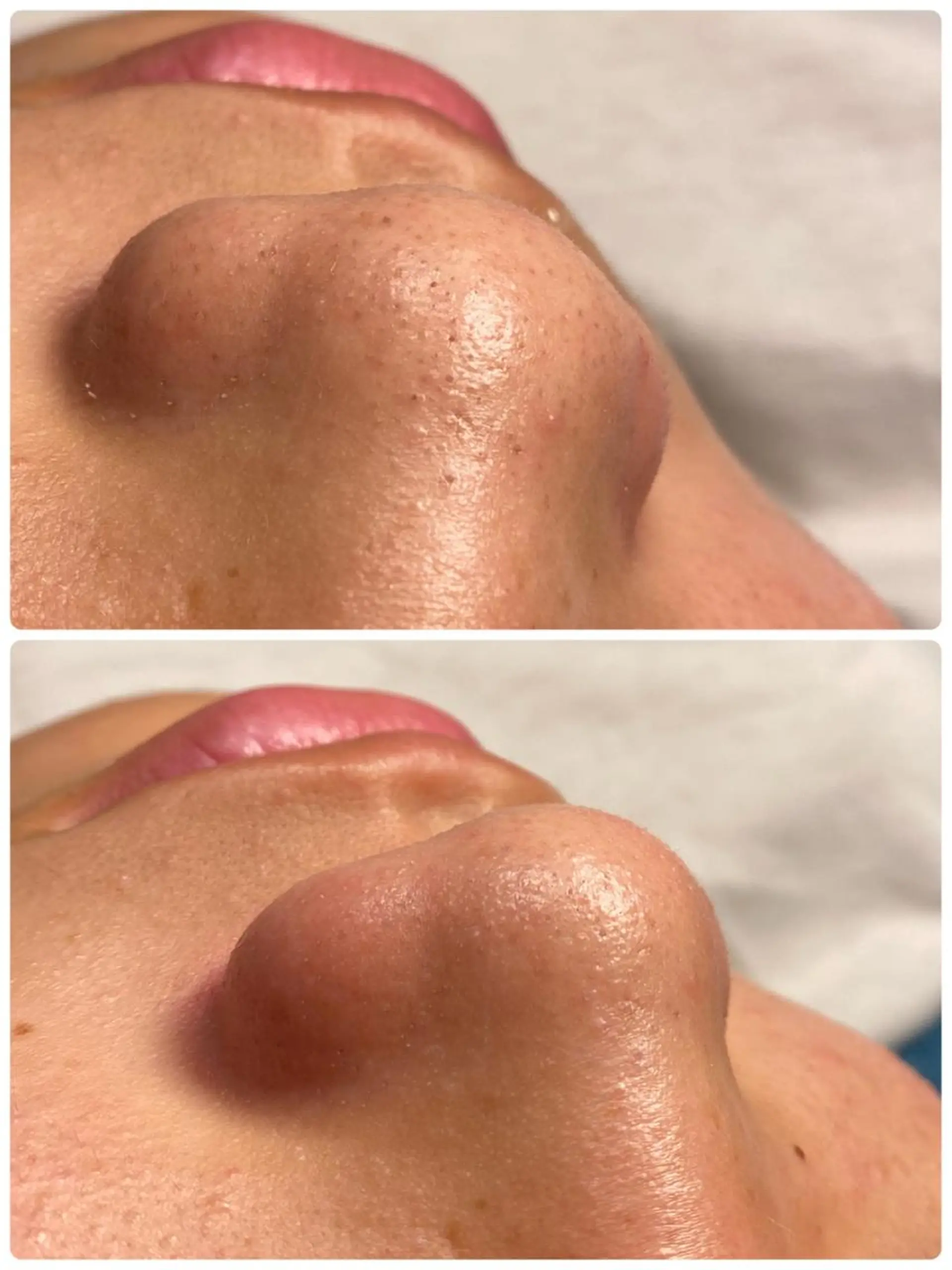 キッズ その他 salon Sunny所属・脱毛salon Sunnyのエステ・リラクイメージ