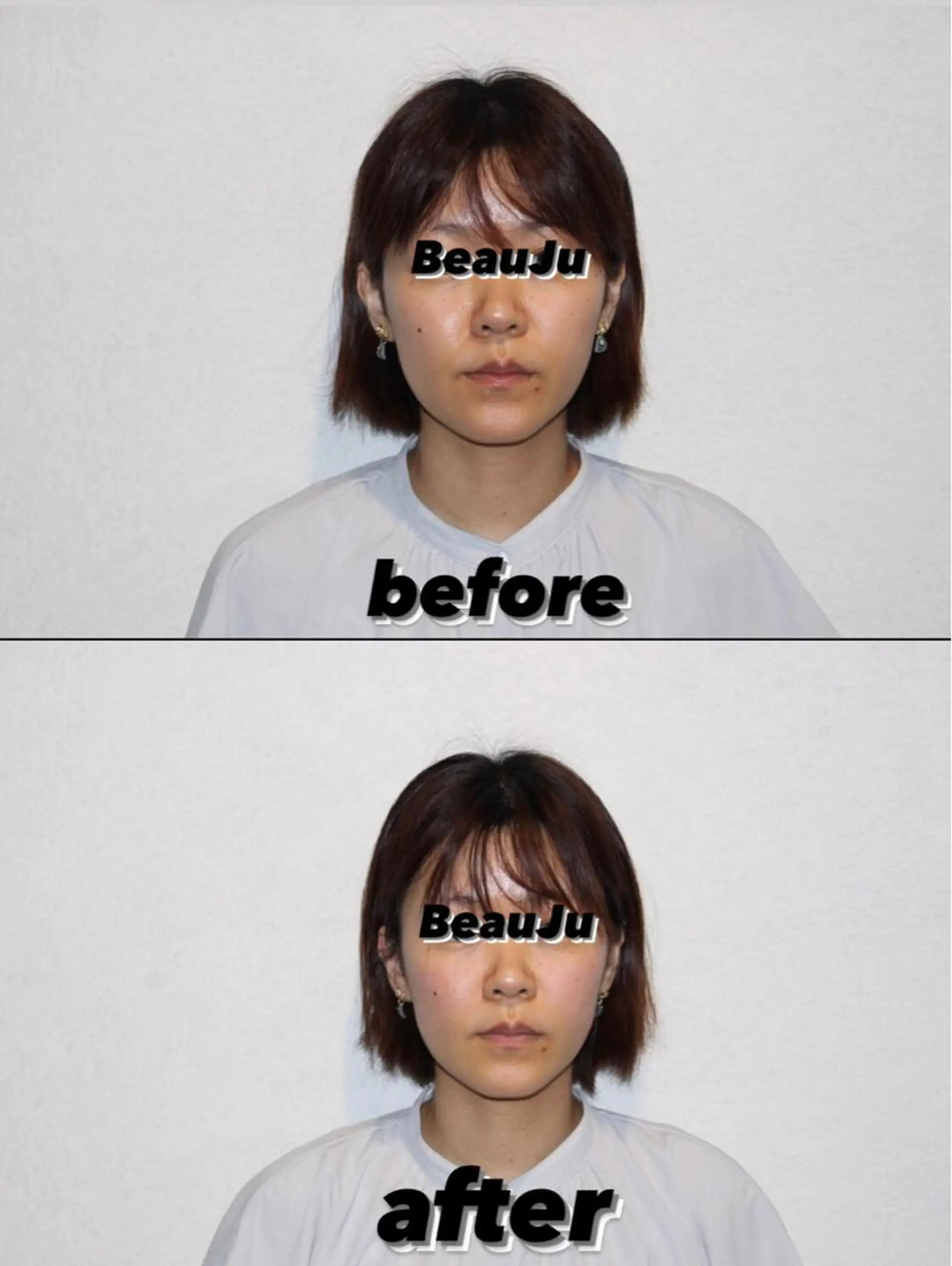 リラク 美容鍼灸整体サロンBeauJu所属・小顔矯/美容鍼/鍼灸 BeauJuのその他イメージ