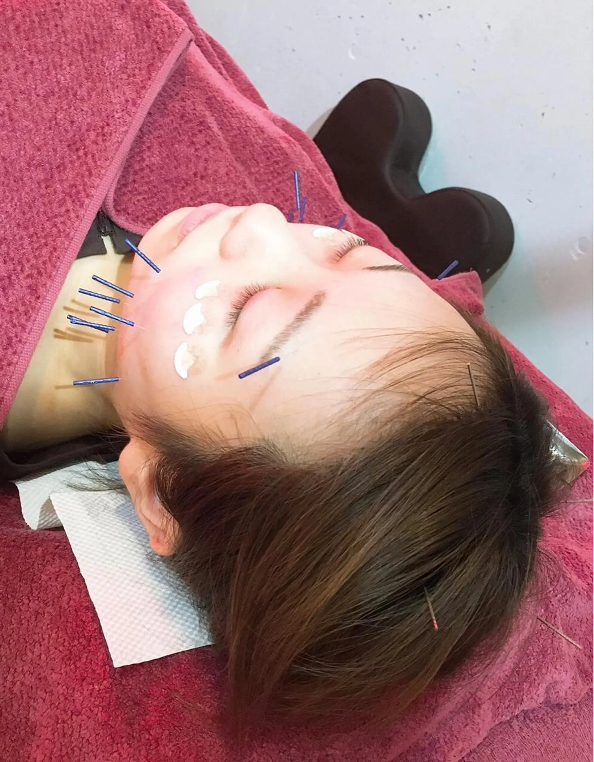 美容鍼灸女性専用 りんご鍼灸治療院のその他イメージ