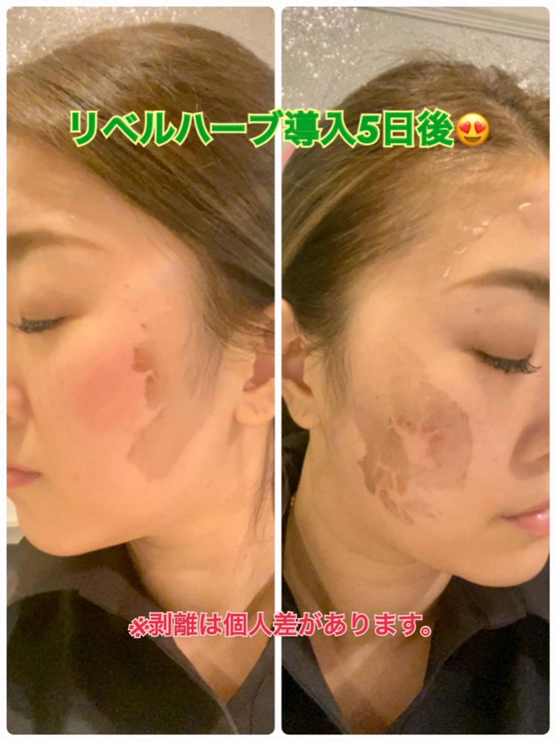 エステ 【リベルハーブピーリング認定店】敏感肌・美白脱毛専門店Dione立川店所属・Dione 立川店のエステ・リラクイメージ