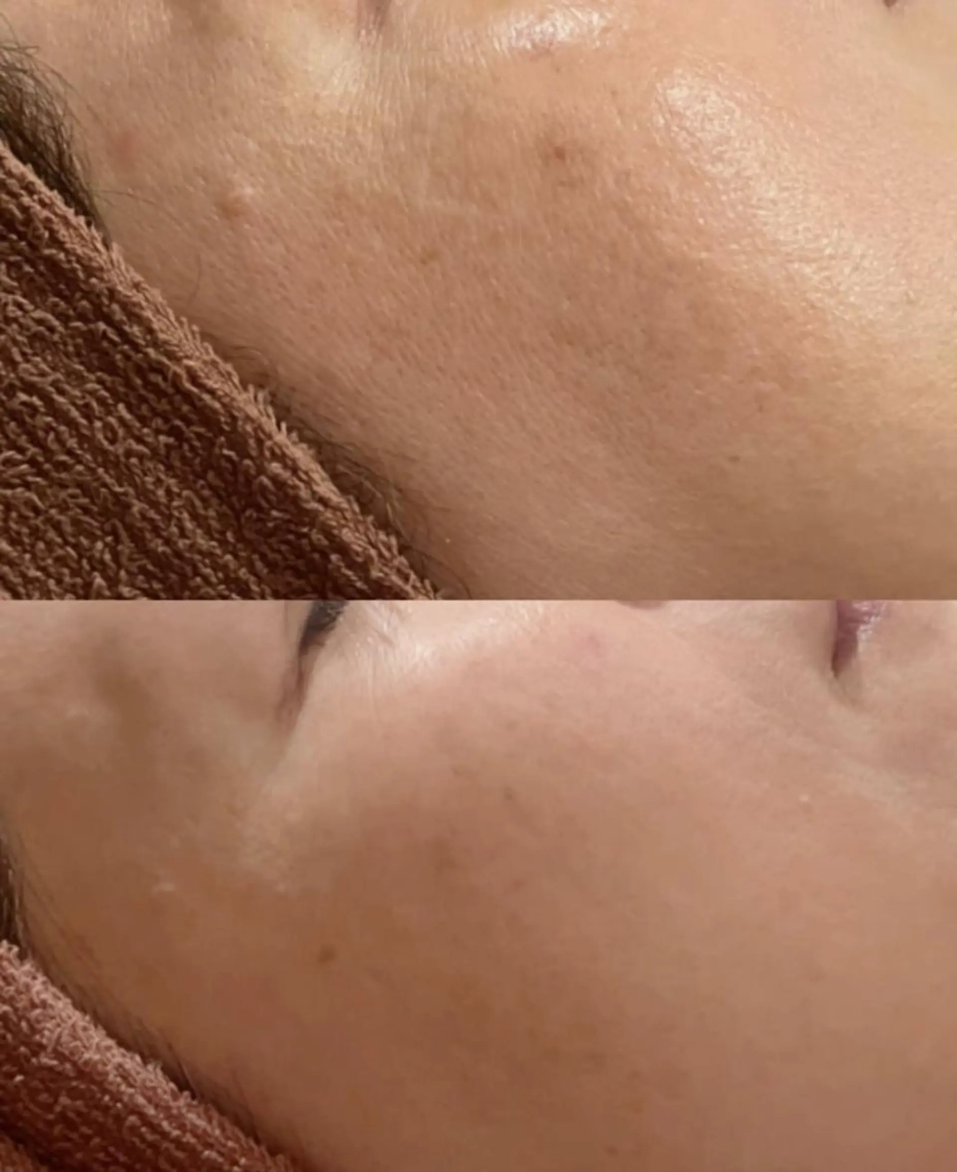 ニキビ・肌質改善専門 ♡人生が変わるサロンのエステ・リラクイメージ