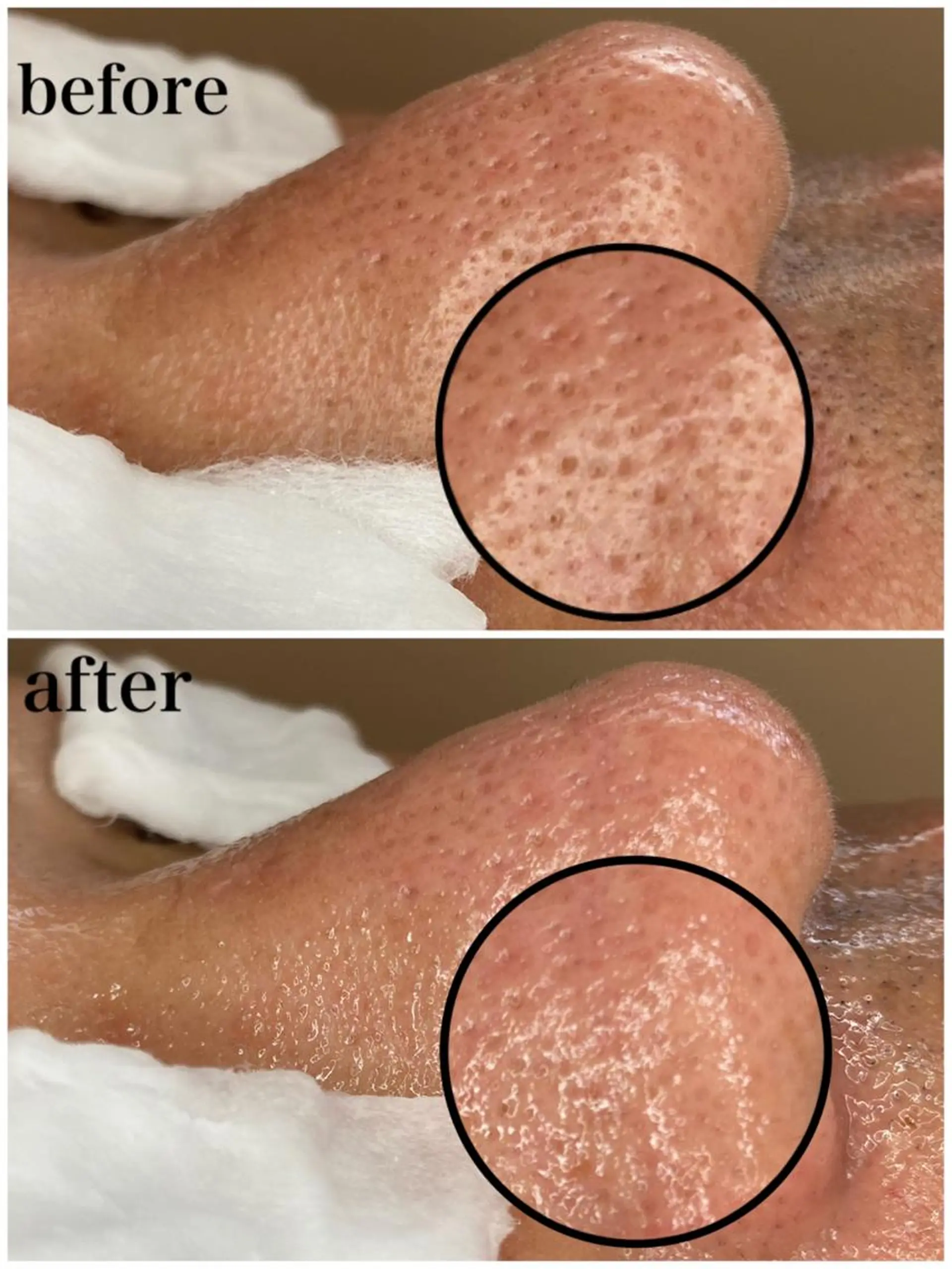 エステ リラク 韓国肌管理 【毛穴専科】のエステ・リラクイメージ