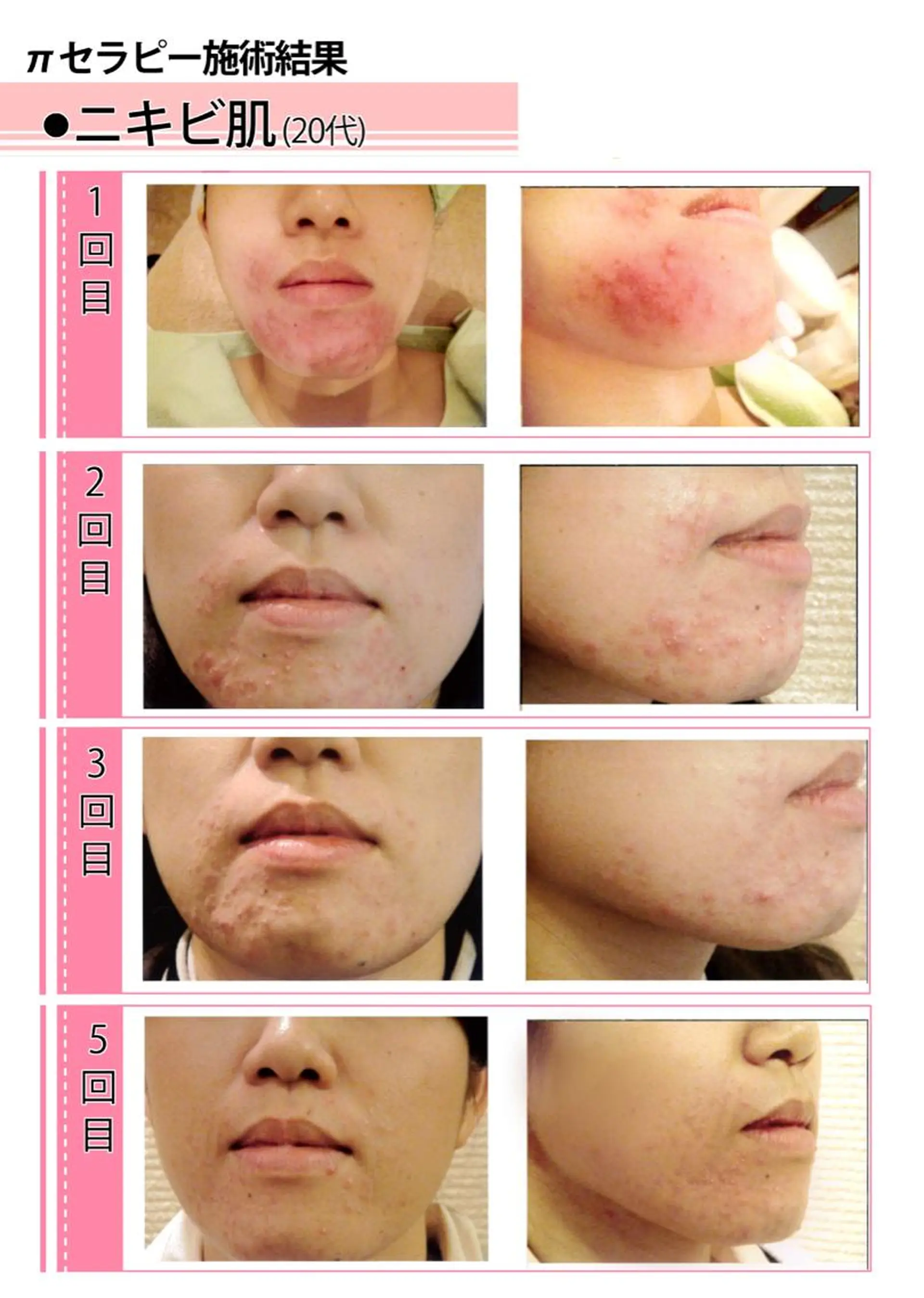 FLEUR大阪・整体 ・ハイフ・痩身・小顔のエステ・リラクイメージ