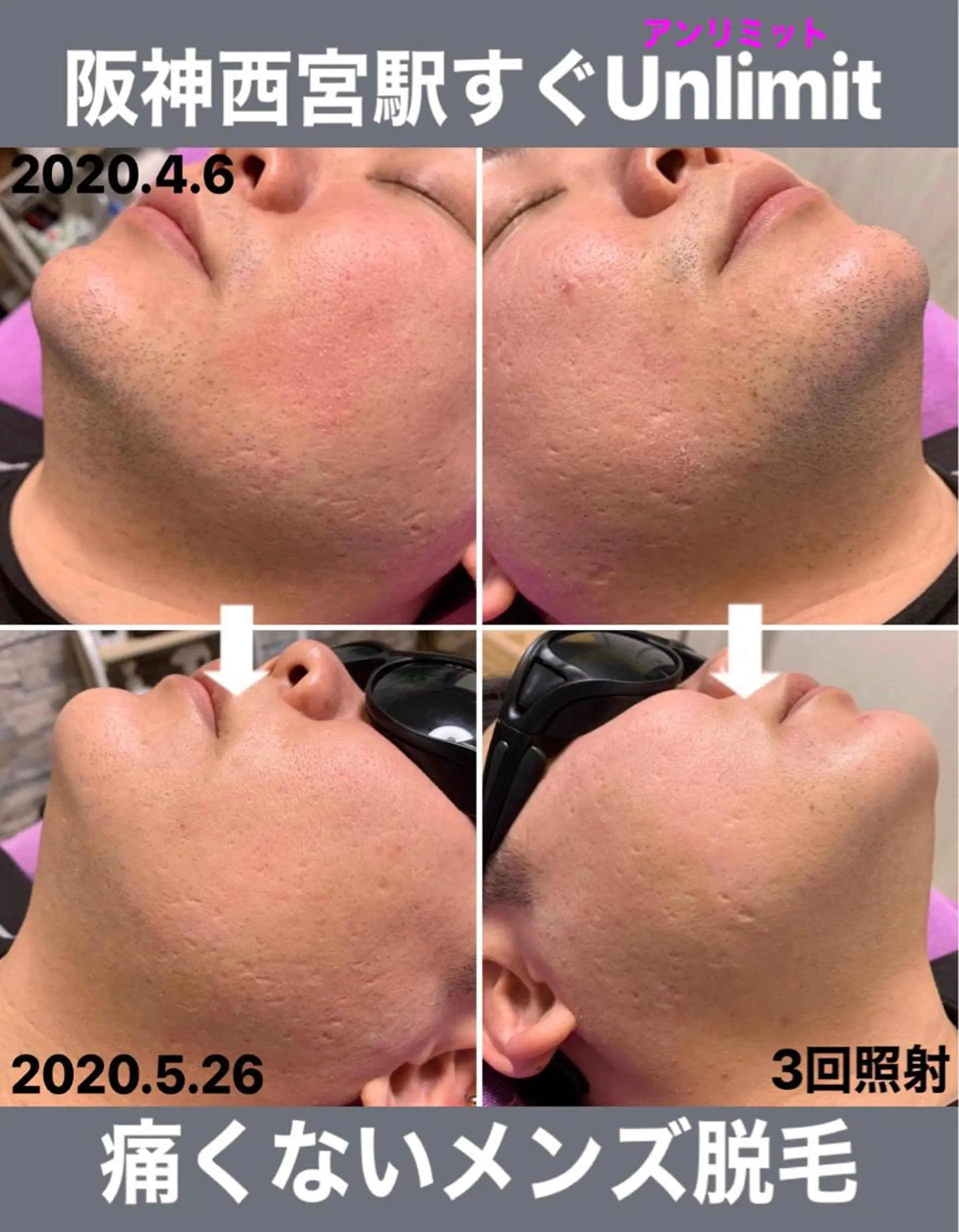 メンズ 脱毛＆エステサロン【アンリミット】所属・森谷 莉美のエステ・リラクイメージ