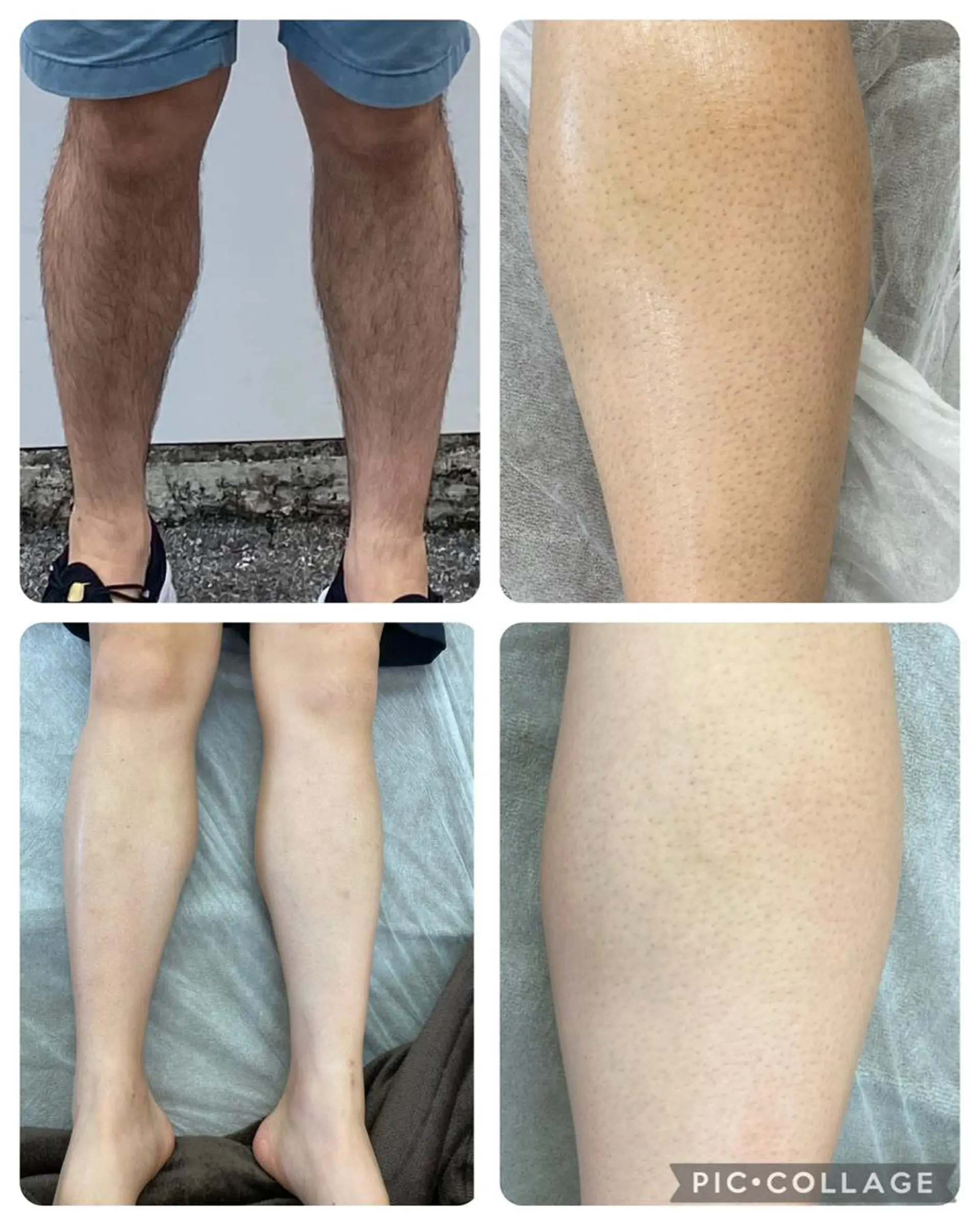 RE:moom リムーム/脱毛エステのエステ・リラクイメージ