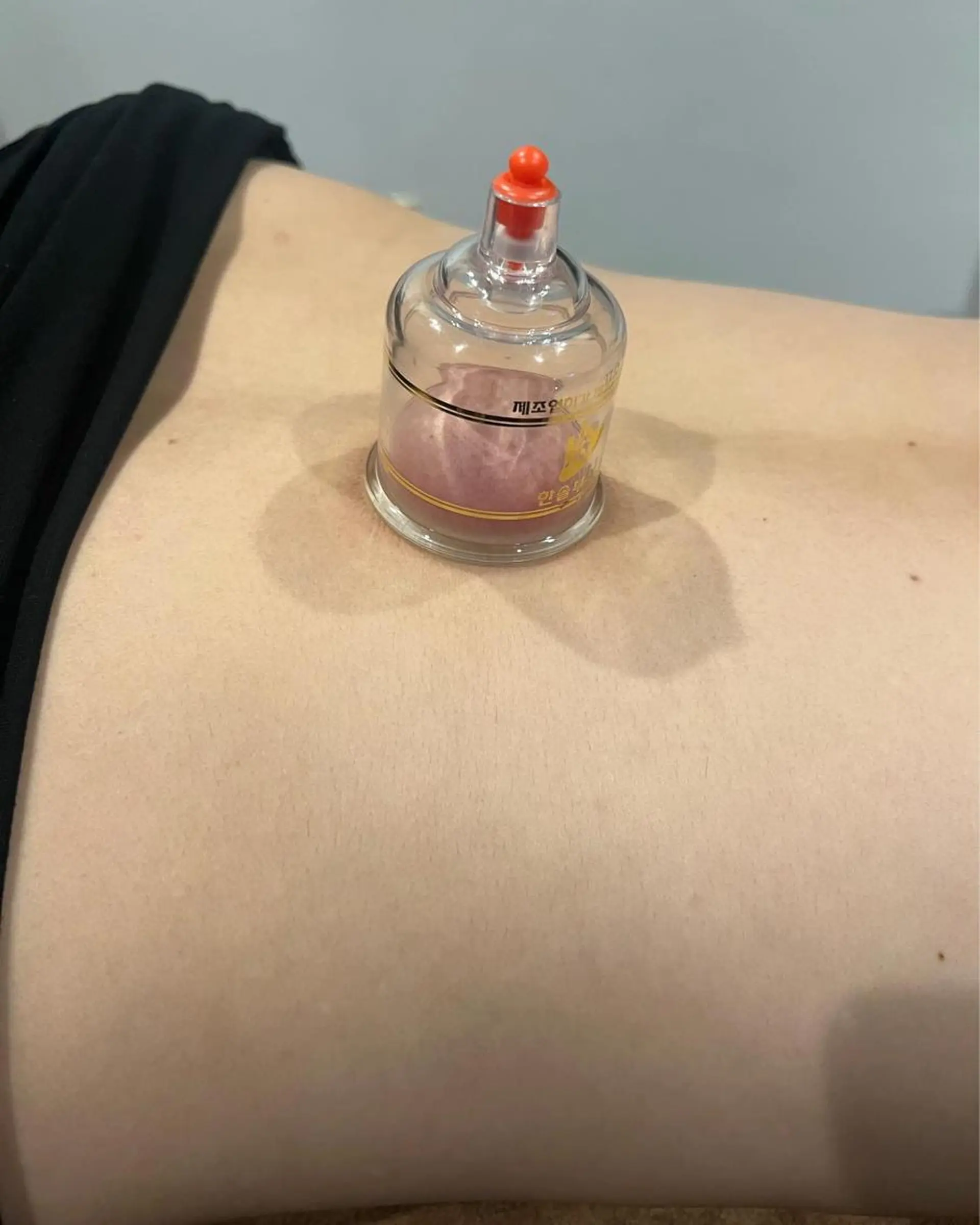 メンズ その他 美容鍼灸サロン LOMIHARIのエステ・リラクイメージ