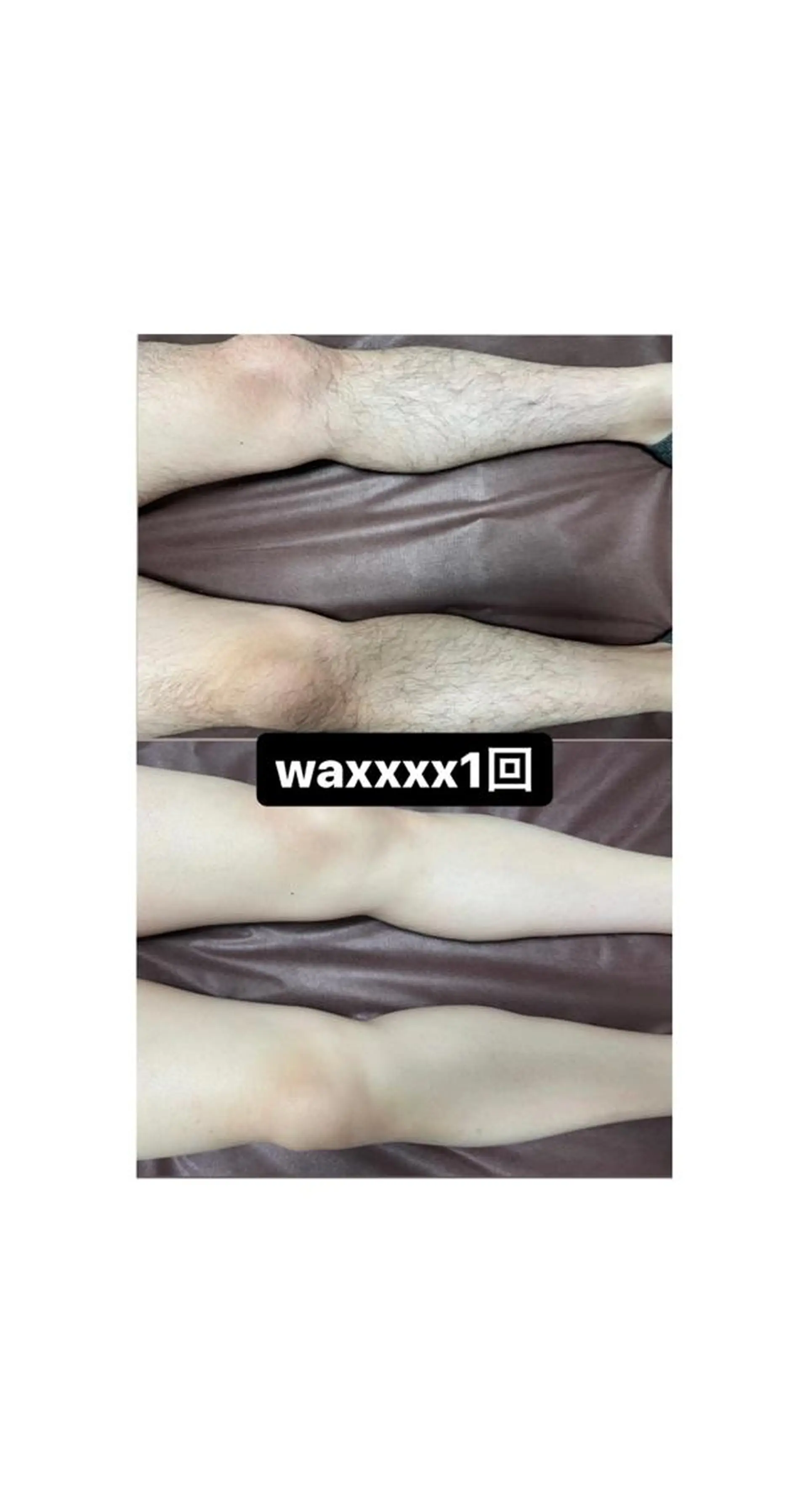 脱毛 Epina 千葉店 【エピナ】のエステ・リラクイメージ