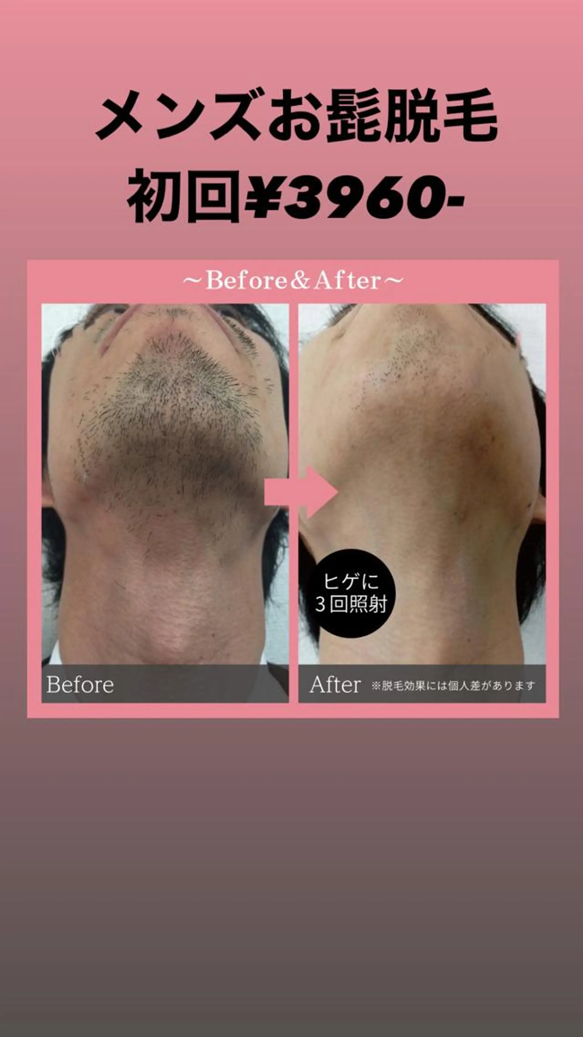 脱毛&エステ GLG 徳並のエステ・リラクイメージ