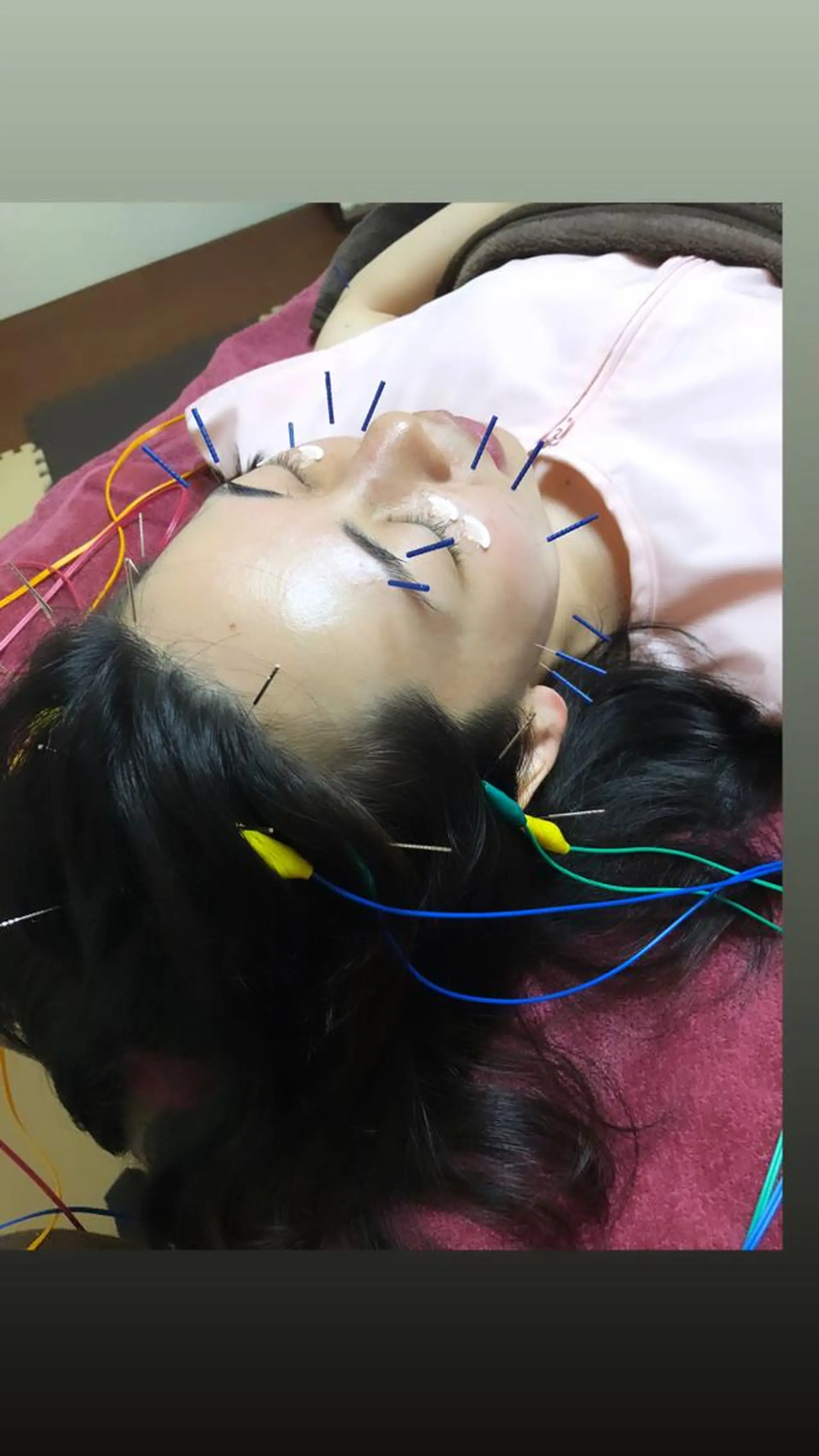 エステ リラク 美容鍼灸女性専用 りんご鍼灸治療院のその他イメージ