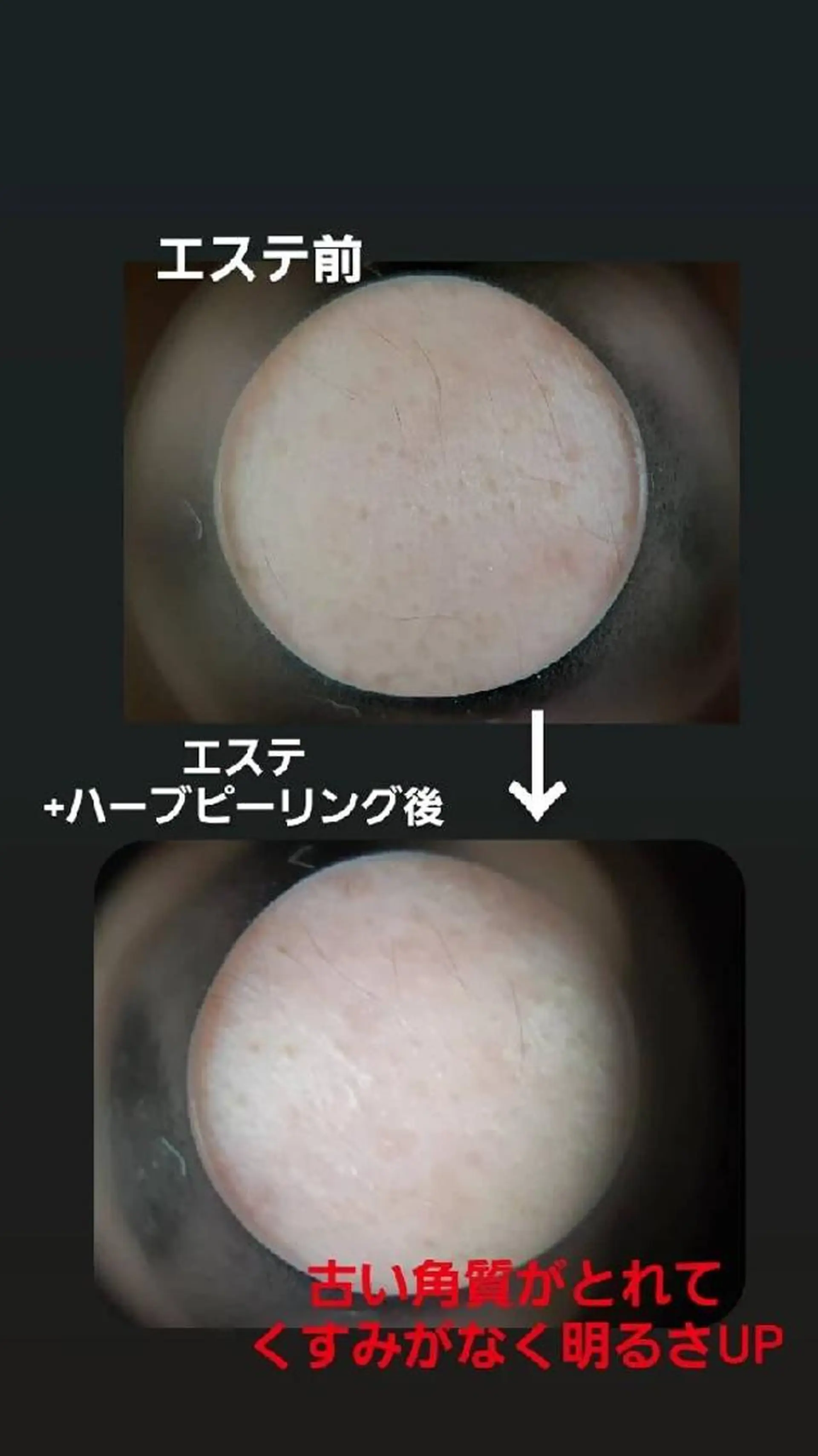 メナードフェイシャルサロン大曽根店所属・ごとう みさきのエステ・リラクイメージ