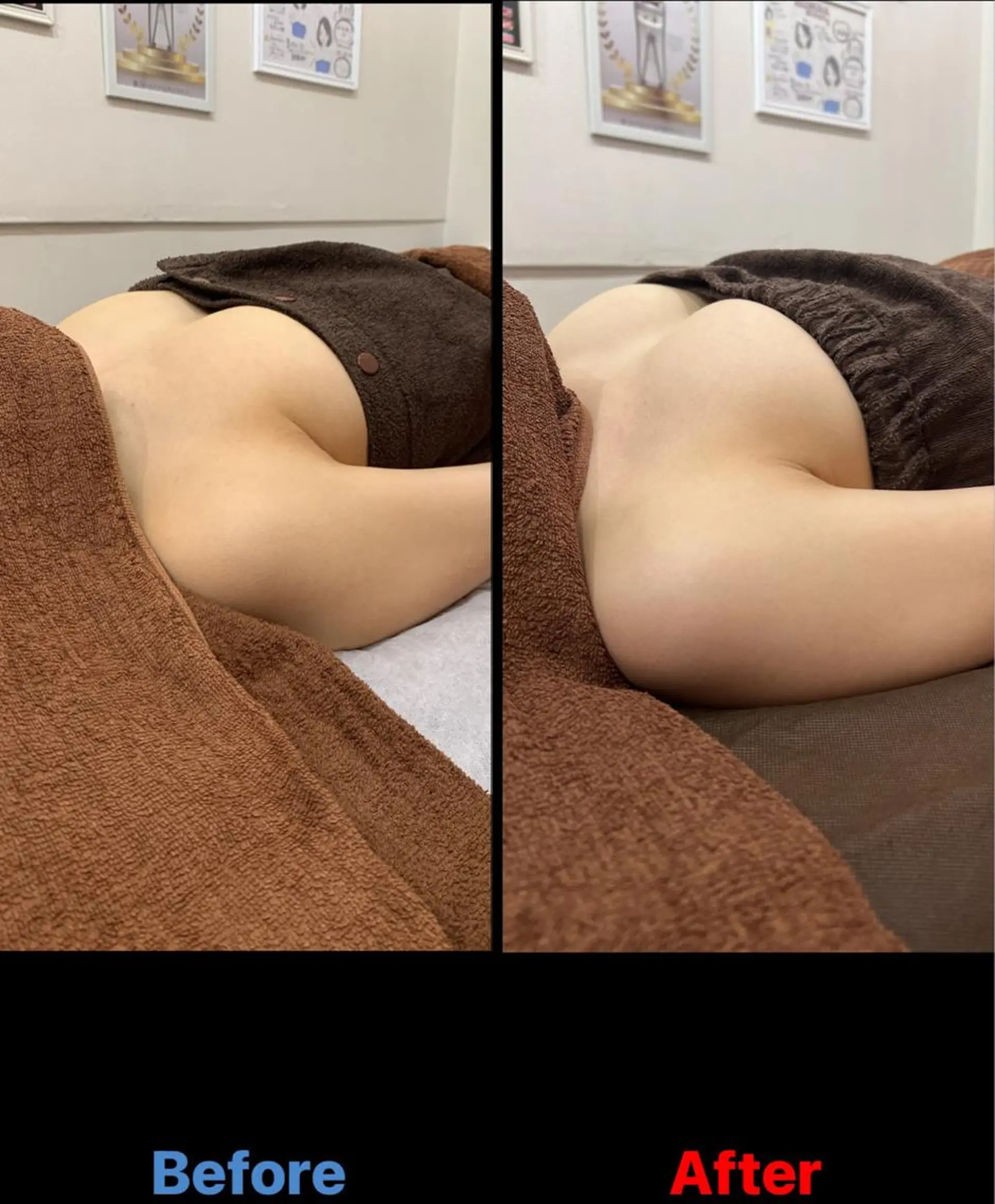 エステ 毛穴改善/脱毛 ネイル 川上久仁子のエステ・リラクイメージ