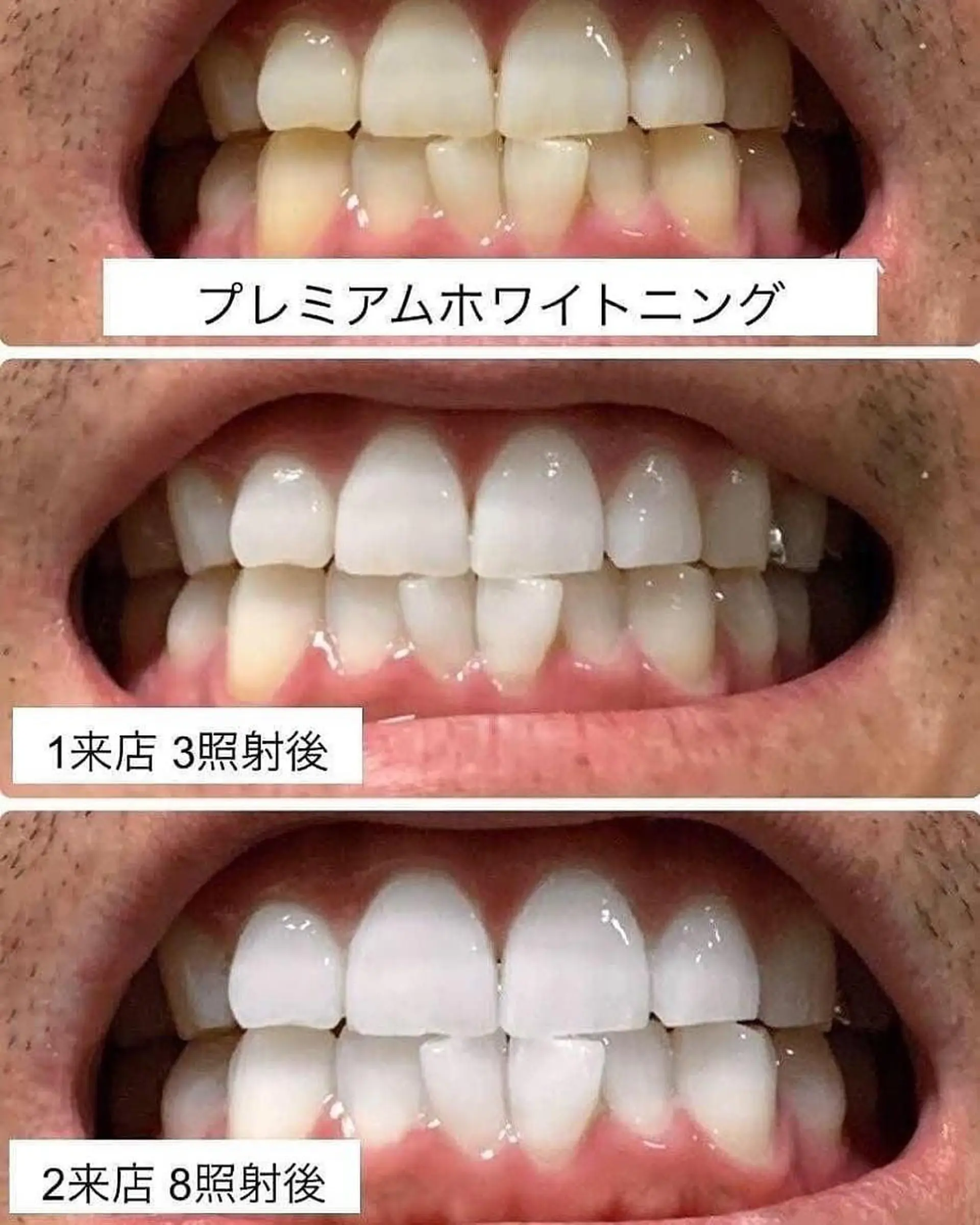プラチナムビューティー柏所属・【歯科連携】柏ホワイ トニング専門店のその他イメージ