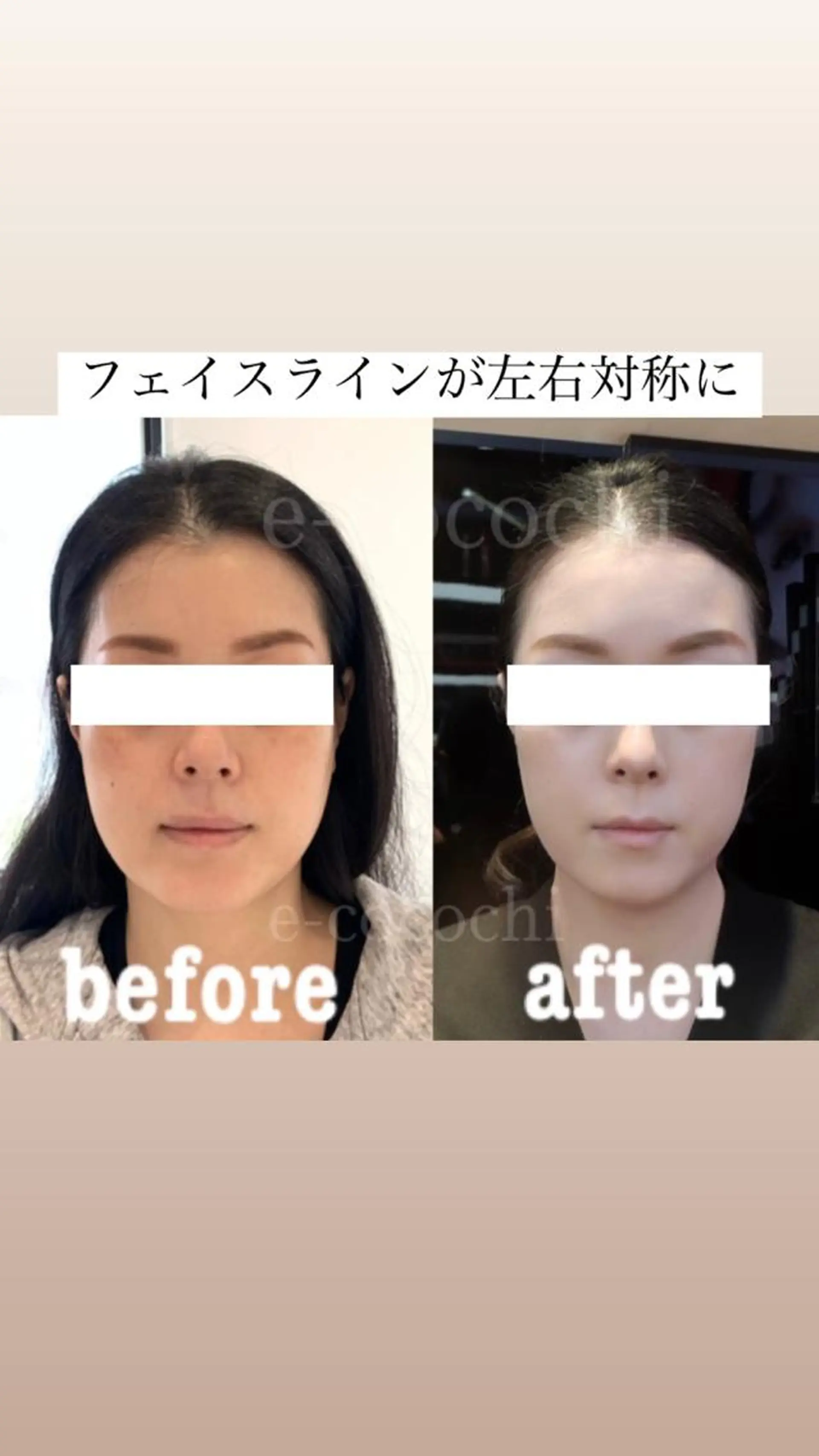 エステ リラク 小顔と ヘッドスパのお店のエステ・リラクイメージ