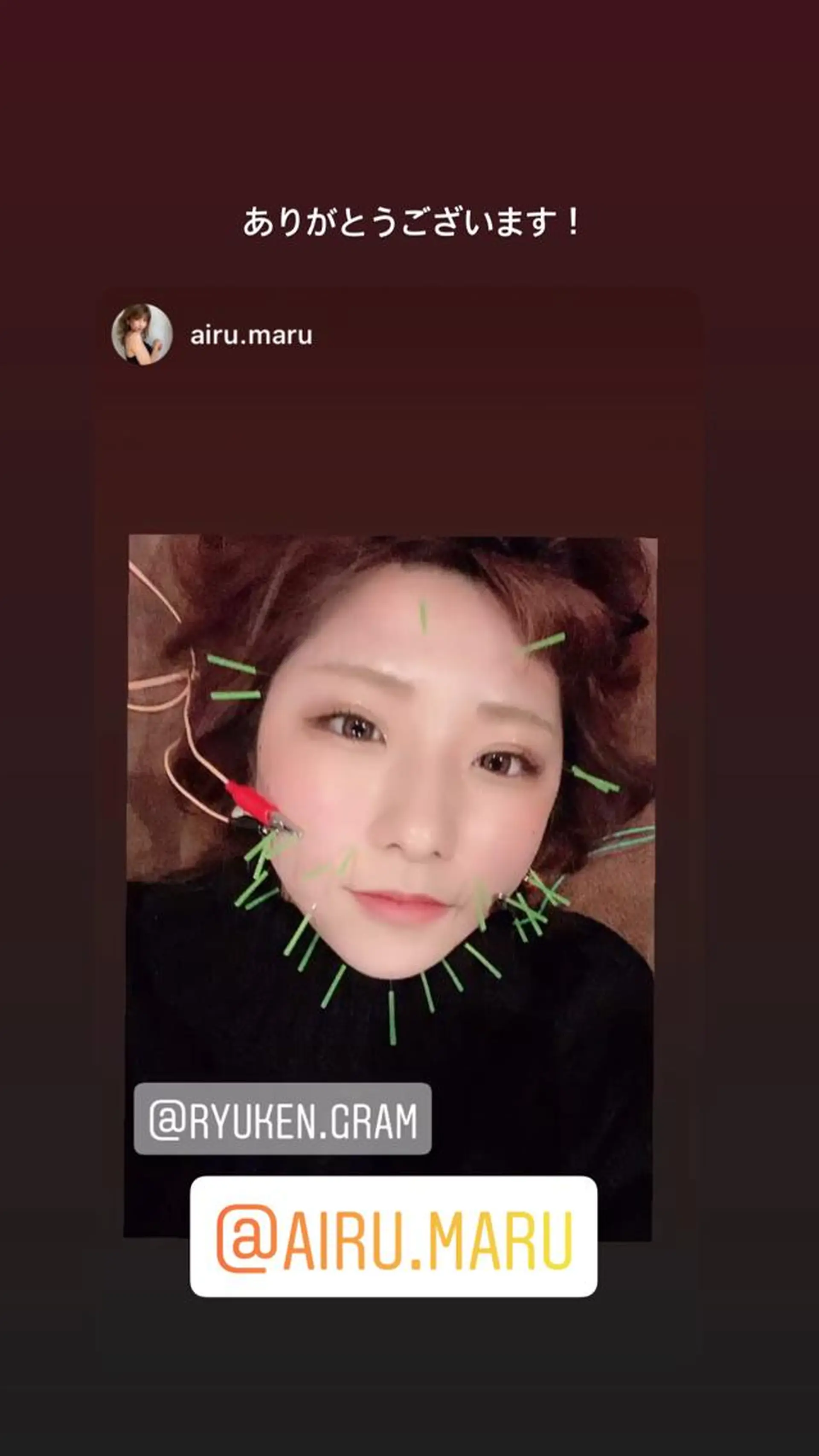 エステ リラク 美容鍼灸サロン LOMIHARIのエステ・リラクイメージ