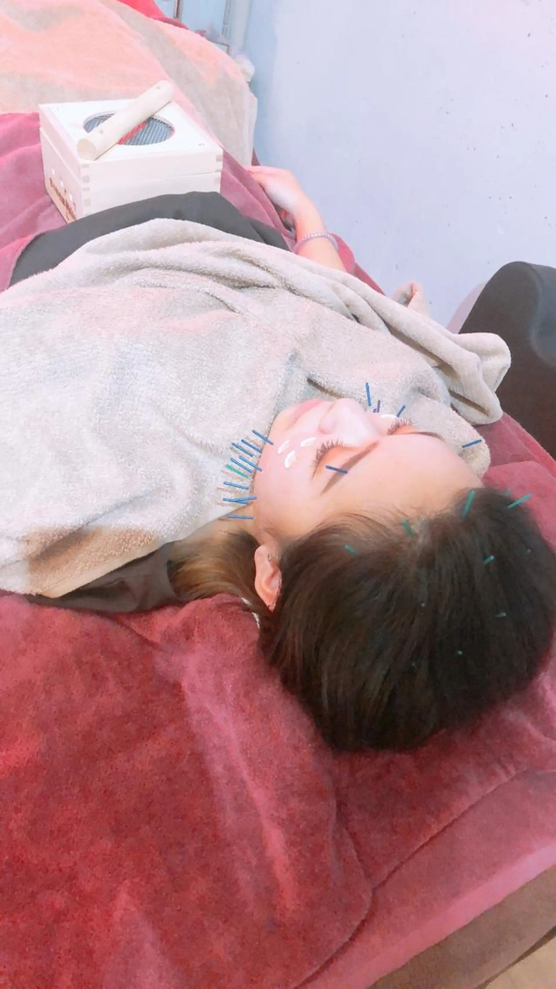 美容鍼灸女性専用 りんご鍼灸治療院のその他イメージ