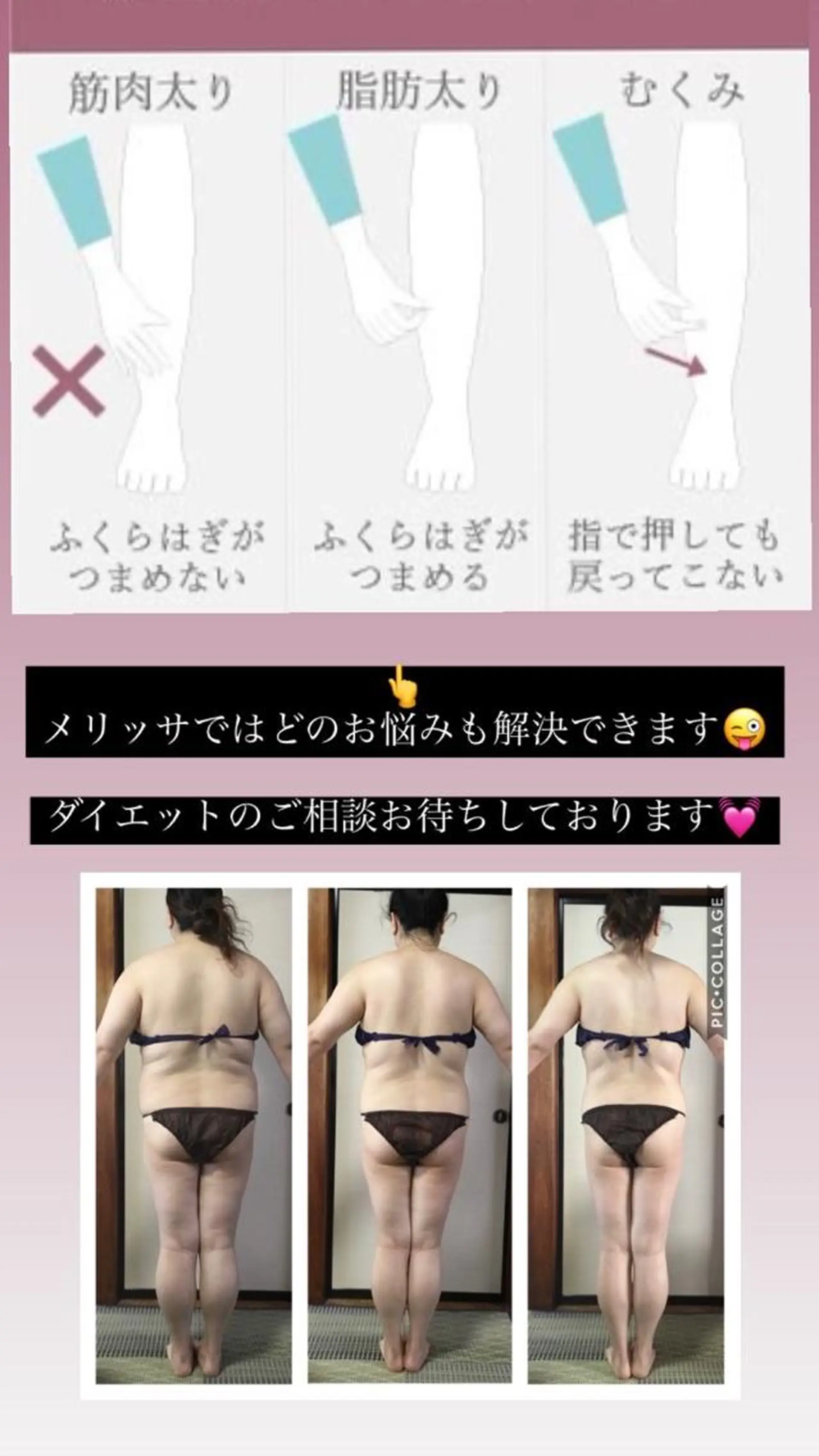 セミロング ヒーリングサロン メリッサ/tooSMILE所属・大屋 詩織のエステ・リラクイメージ