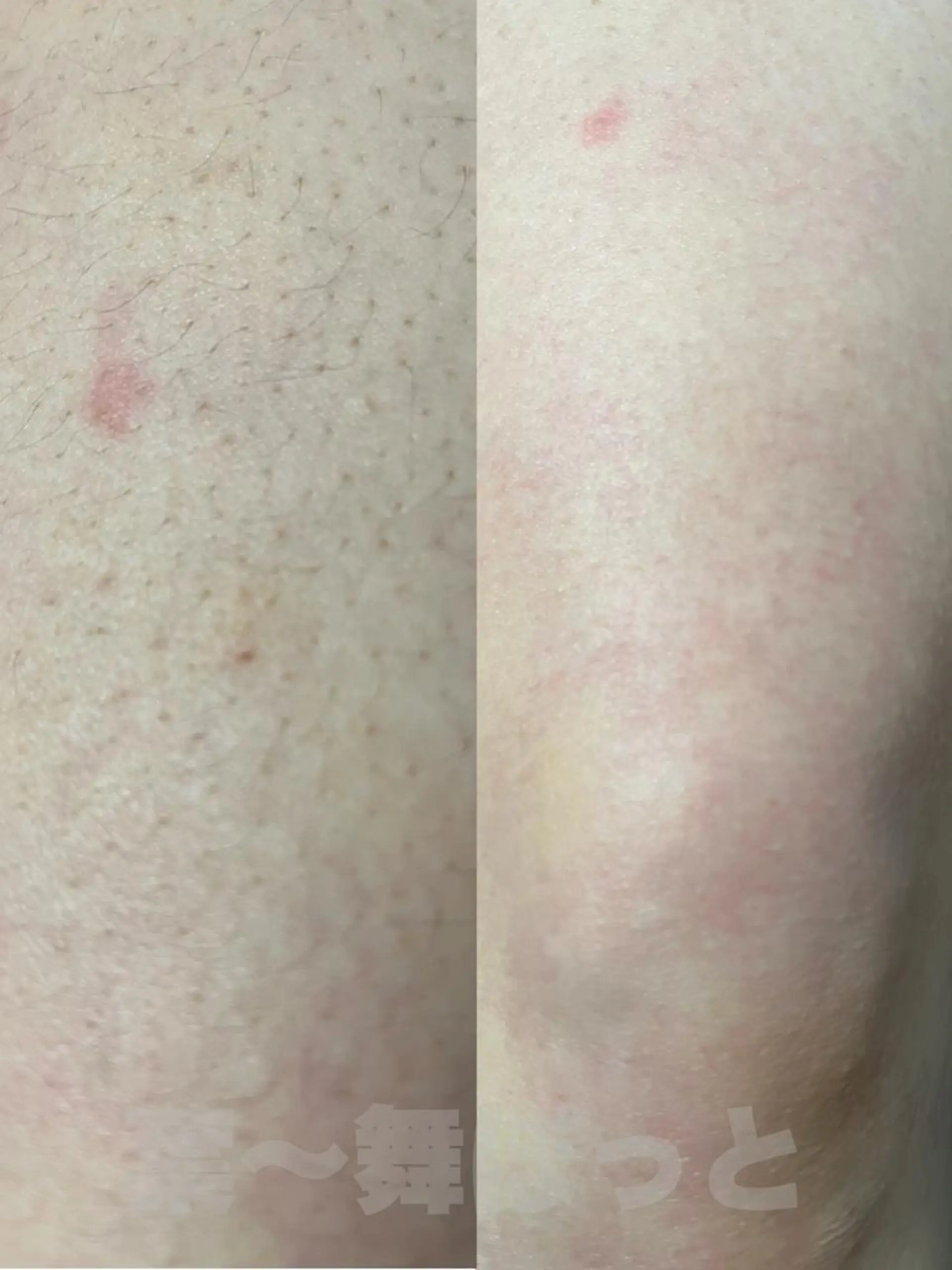 うえつま ふみえのエステ・リラクイメージ