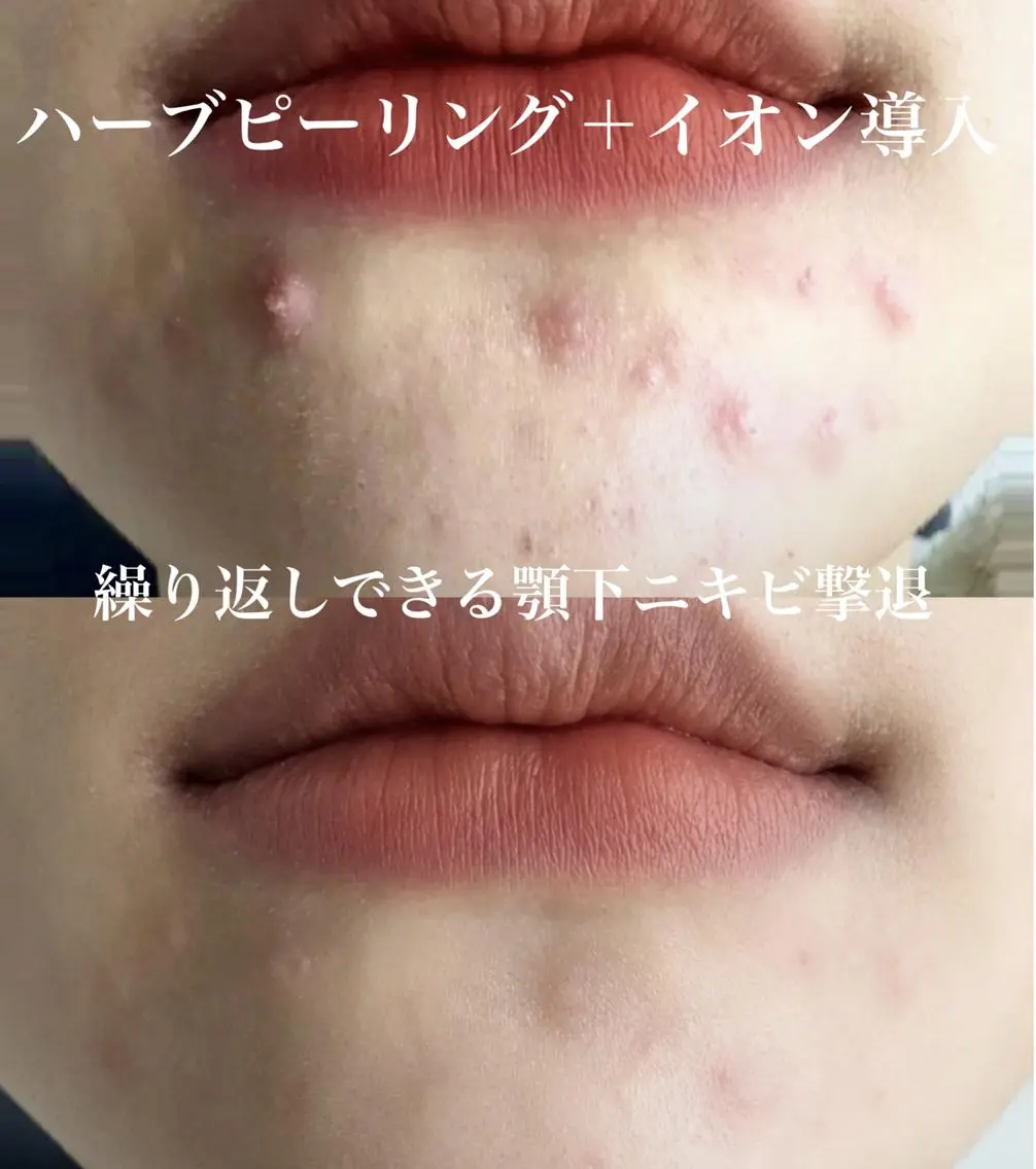 M LABO 銀座店のエステ・リラクイメージ