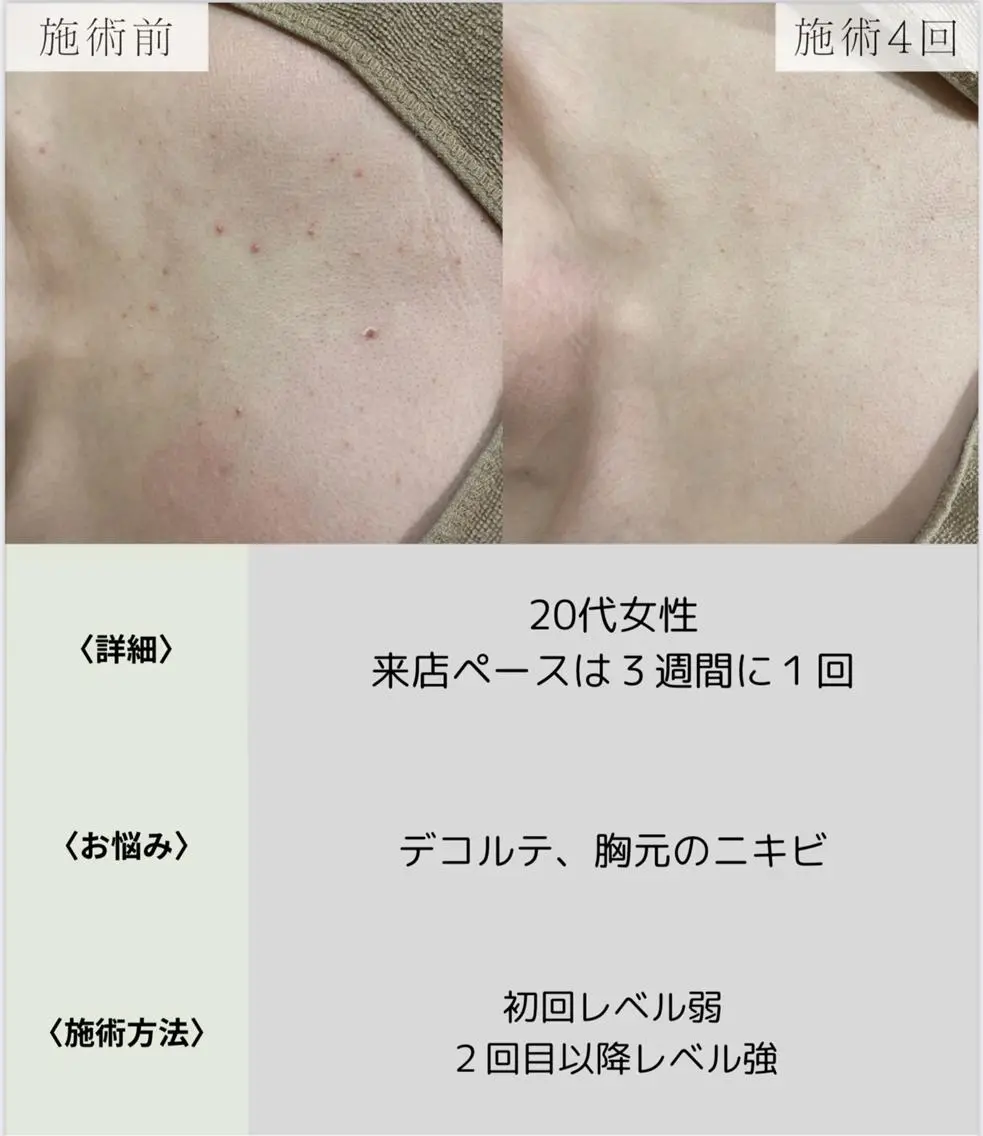 脱毛・眉毛・フェイス サロンN久留米店のエステ・リラクイメージ