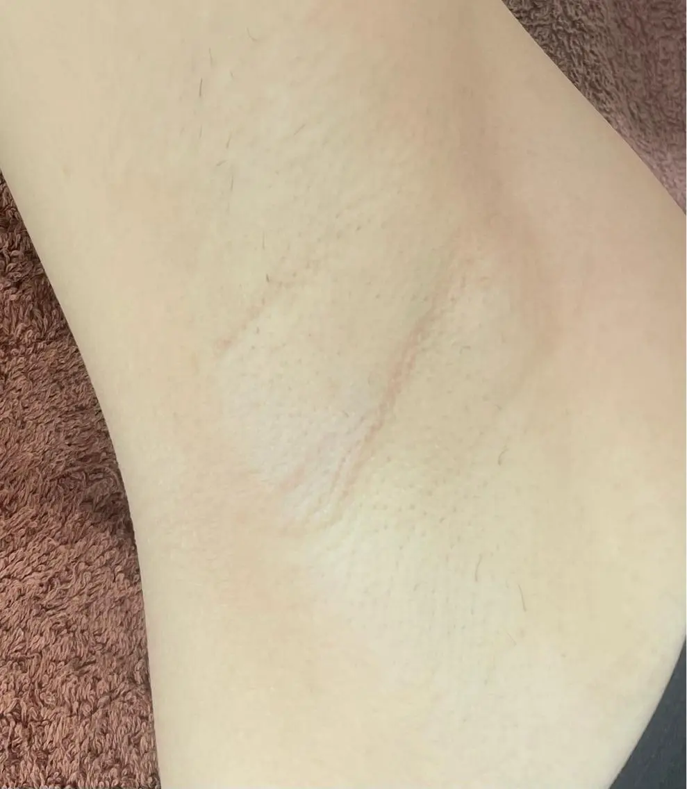 脱毛 LY　SALON♡ トータルビューティーのエステ・リラクイメージ