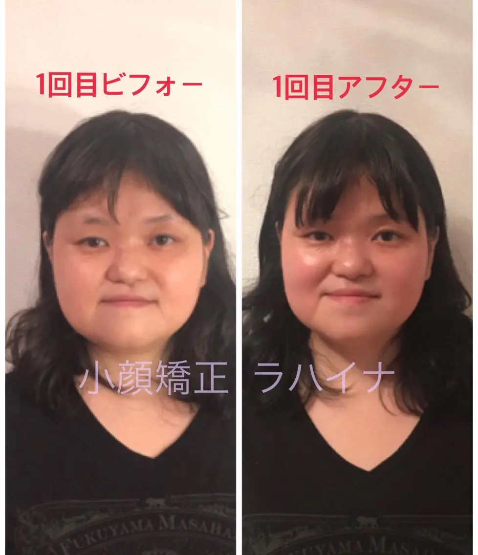 エステ リラク 小顔矯正 ラハイナのエステ・リラクイメージ