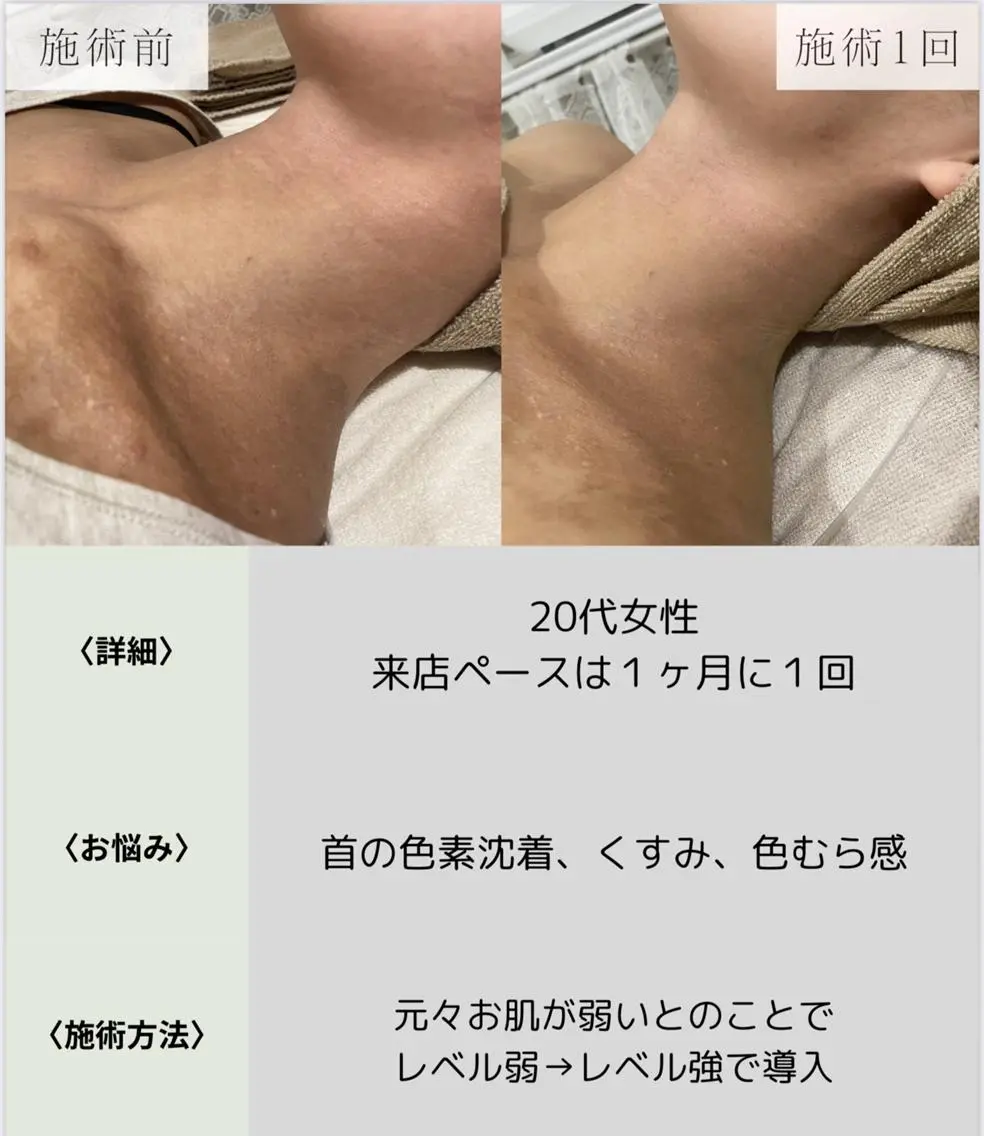 脱毛・眉毛・フェイス サロンN久留米店のエステ・リラクイメージ