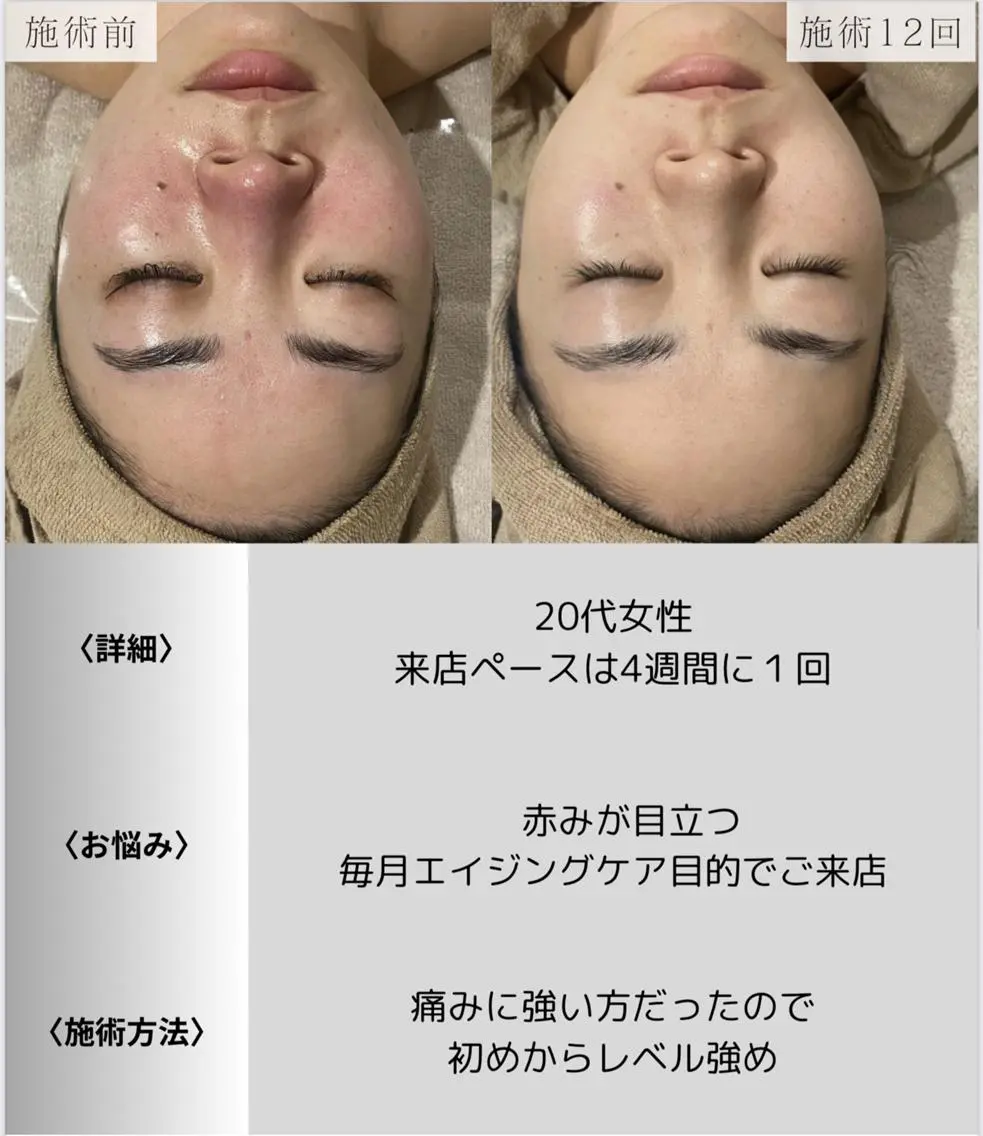 脱毛・眉毛・フェイス サロンN久留米店の眉毛・アイブロウイメージ