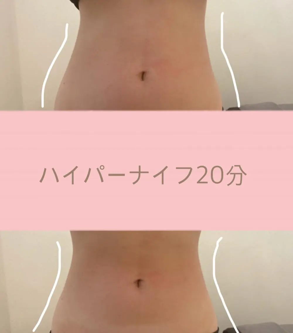 OPREA 千種店のエステ・リラクイメージ